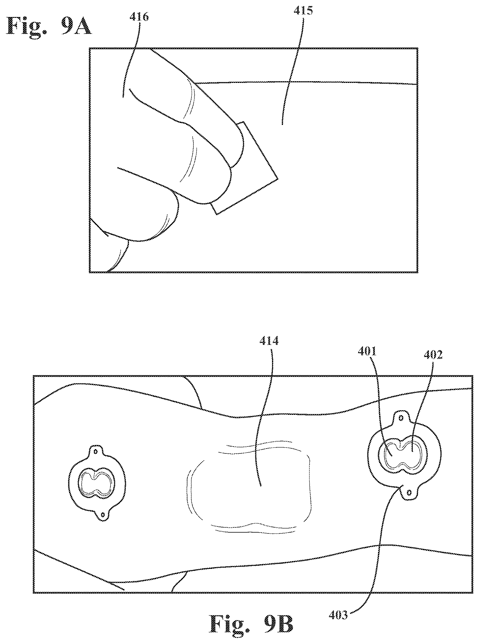 Patent US12569195 Figure 12 – Systems and methods for monitoring physical therapy of the knee and other joints