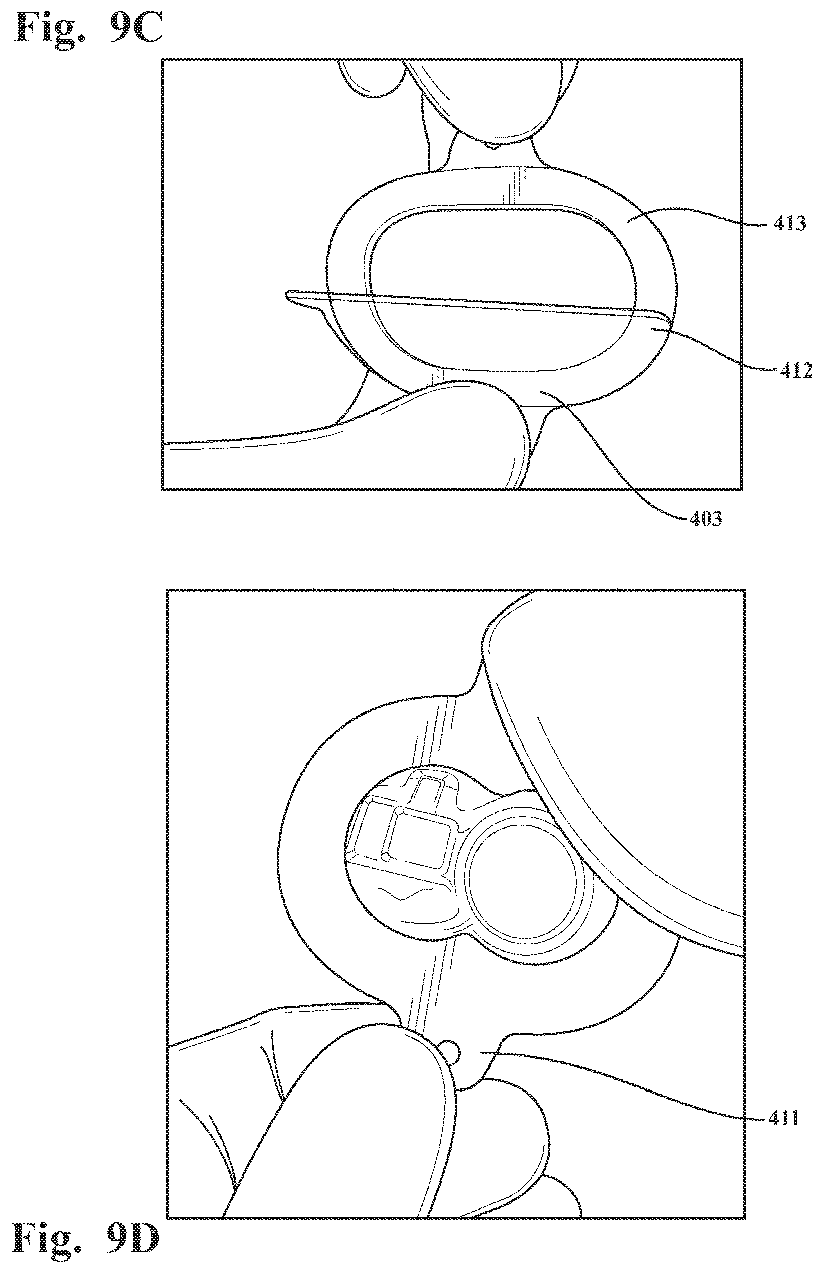 Patent US12569195 Figure 13 – Systems and methods for monitoring physical therapy of the knee and other joints