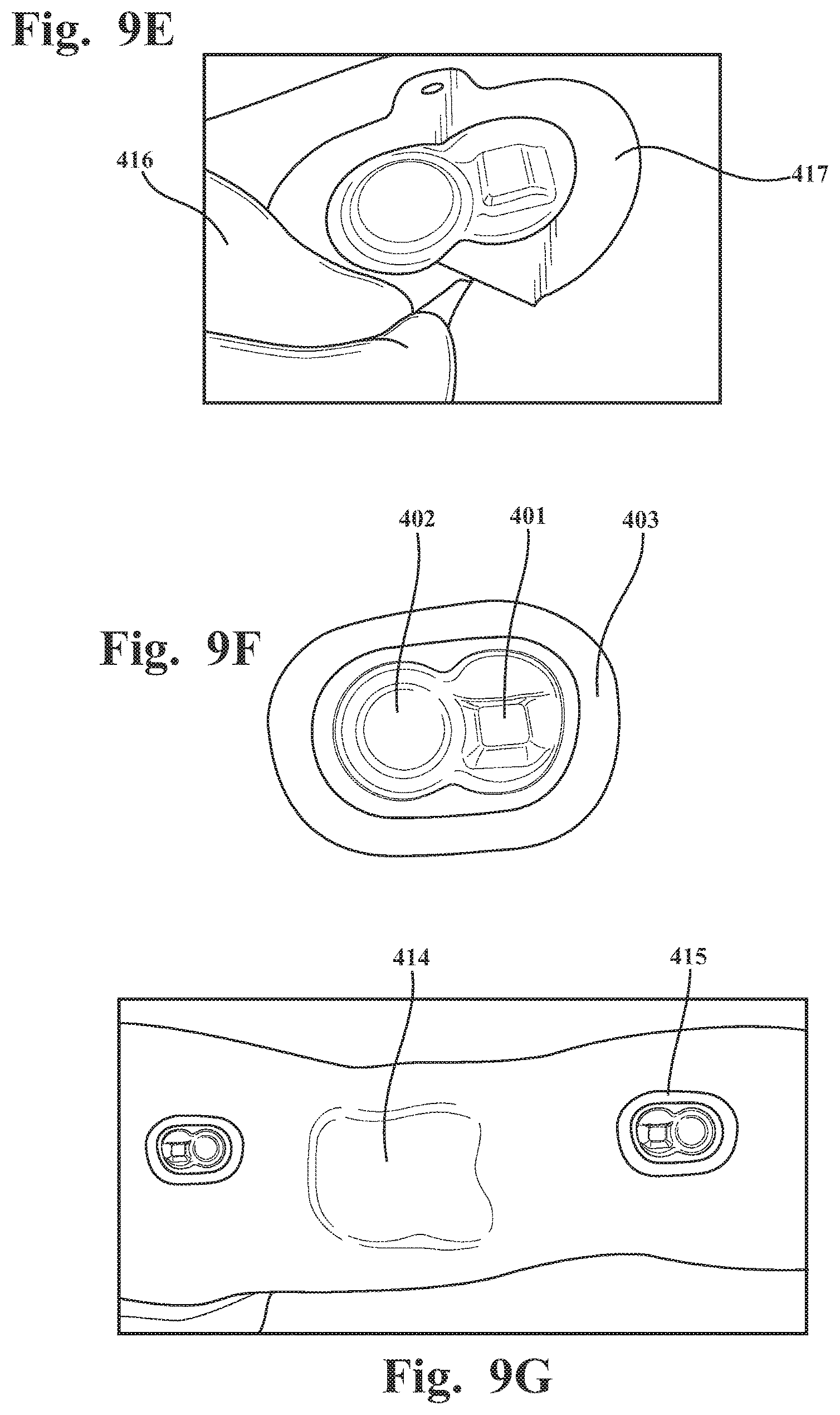 Patent US12569195 Figure 14 – Systems and methods for monitoring physical therapy of the knee and other joints