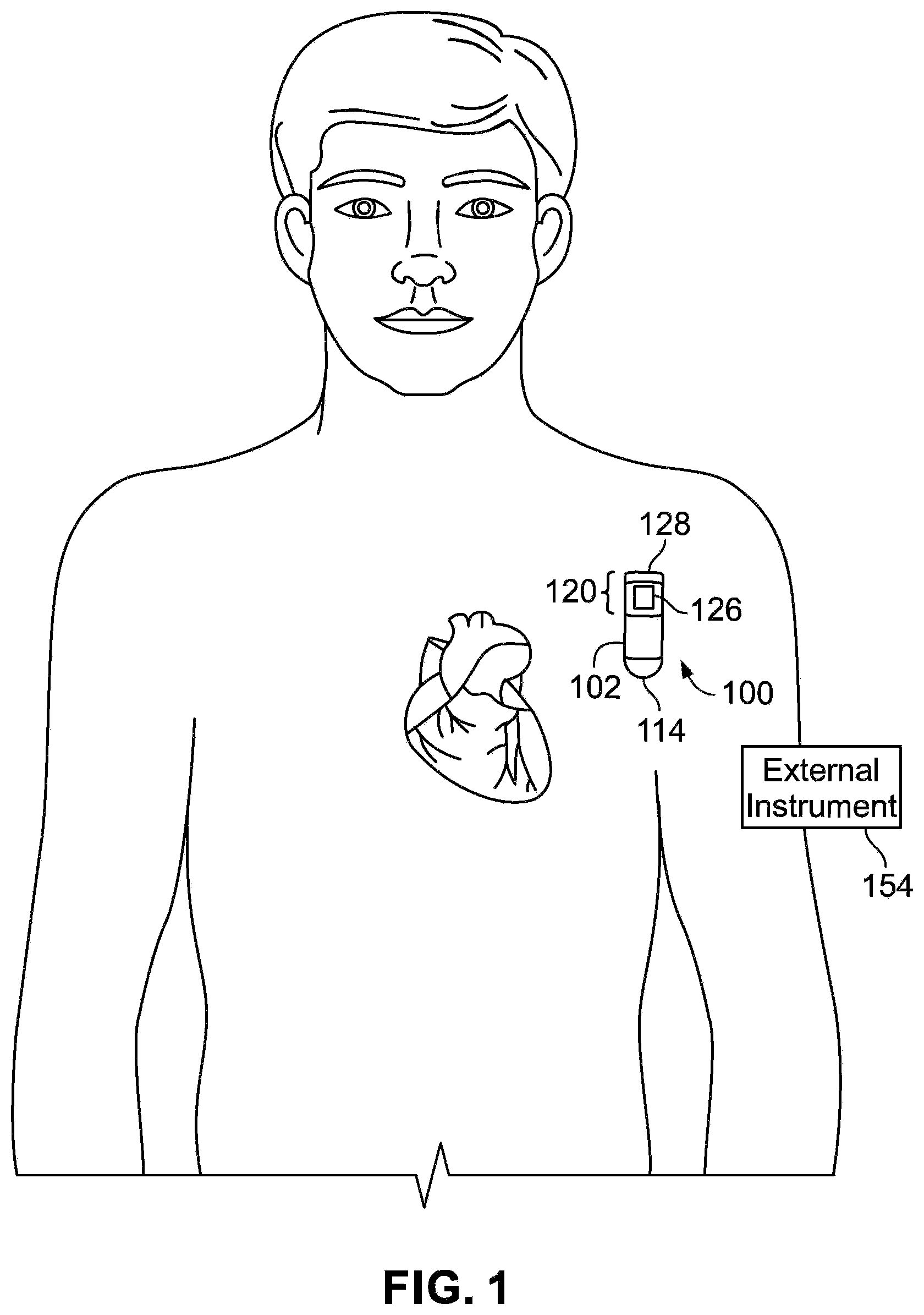 Patent US12569205 Figure 1 – Implantable medical device data and diagnostics management system method using machine-learning architecture