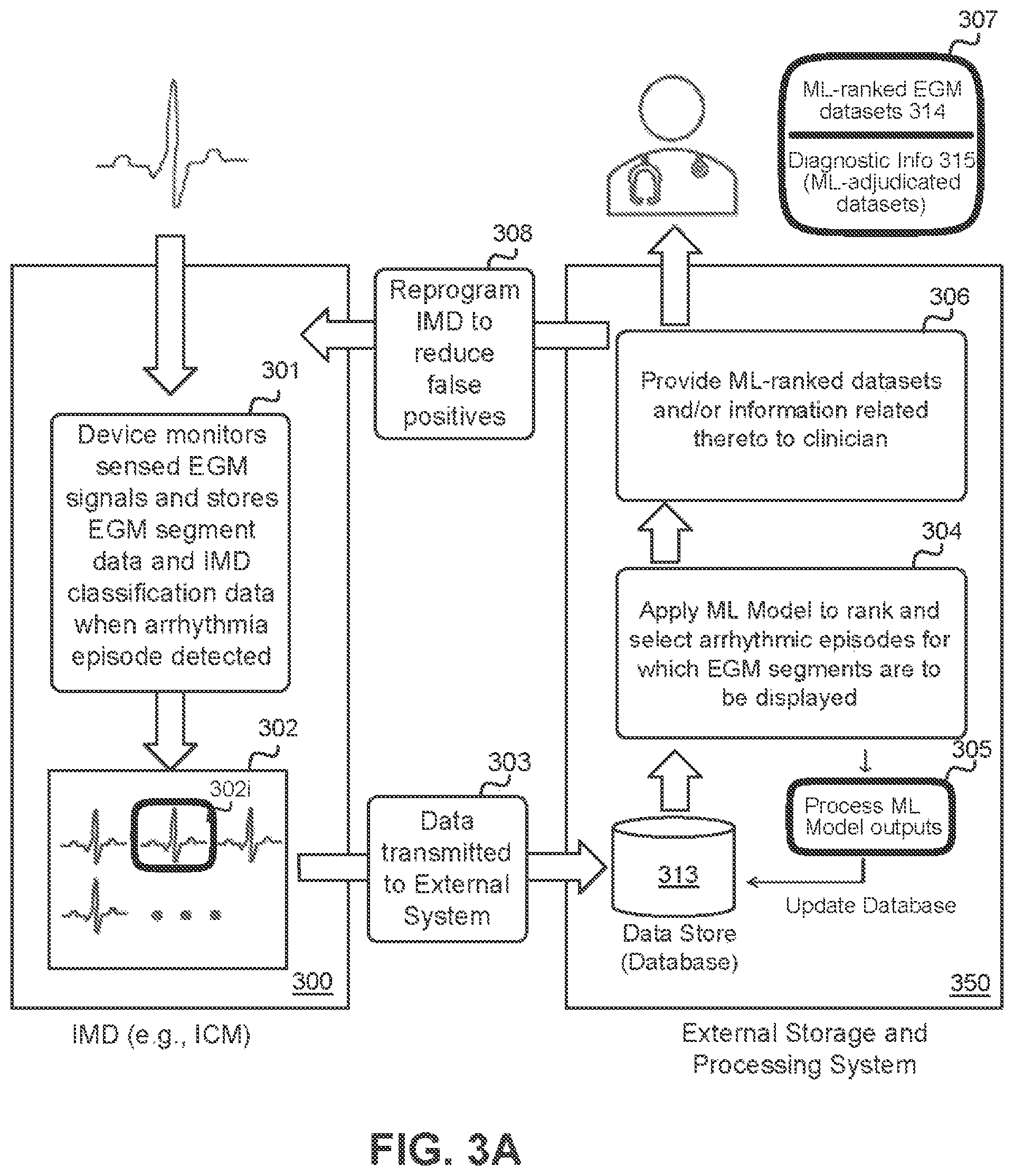 Patent US12569205 Figure 3 – Implantable medical device data and diagnostics management system method using machine-learning architecture
