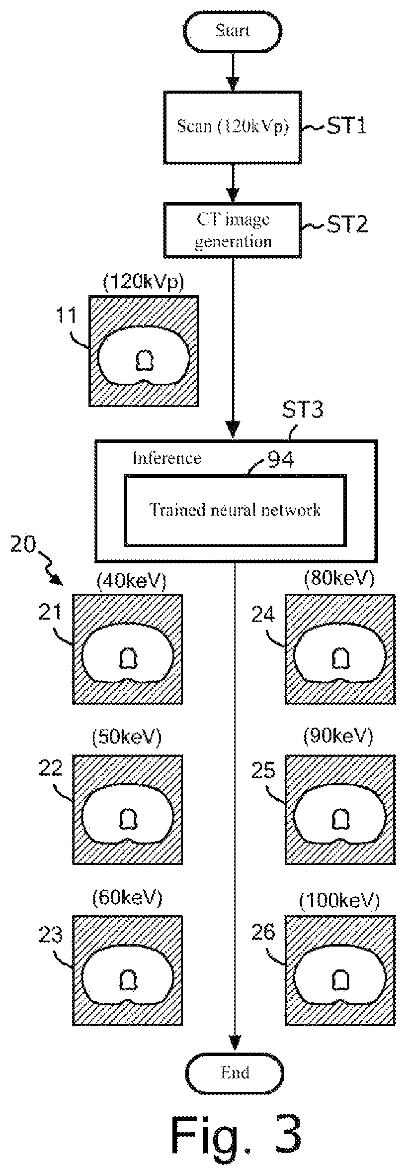 Patent US12569207 Figure 3 – Device for inferring virtual monochromatic x-ray image, CT system, method of creating trained neural network, and storage medium