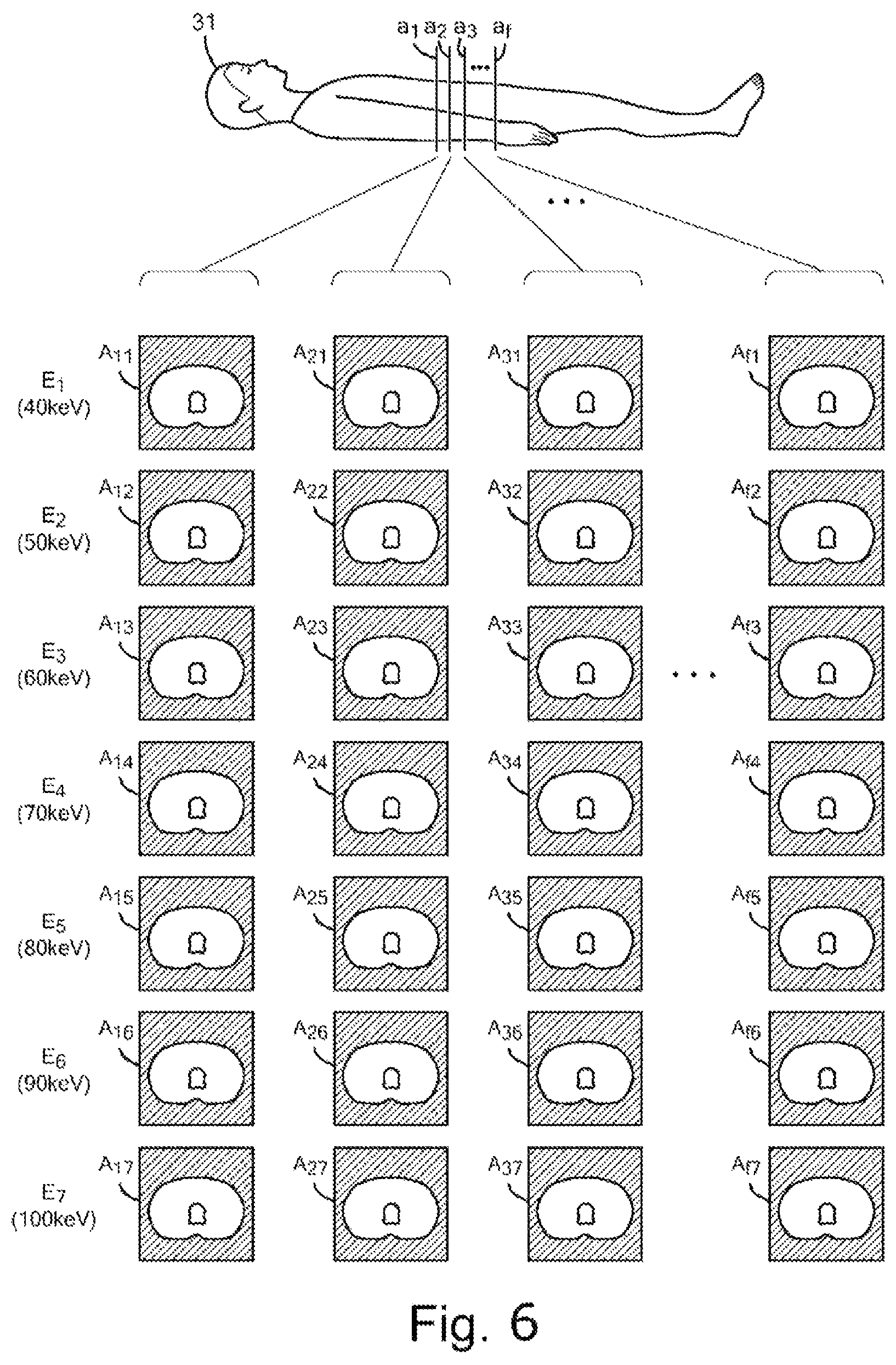 Patent US12569207 Figure 6 – Device for inferring virtual monochromatic x-ray image, CT system, method of creating trained neural network, and storage medium