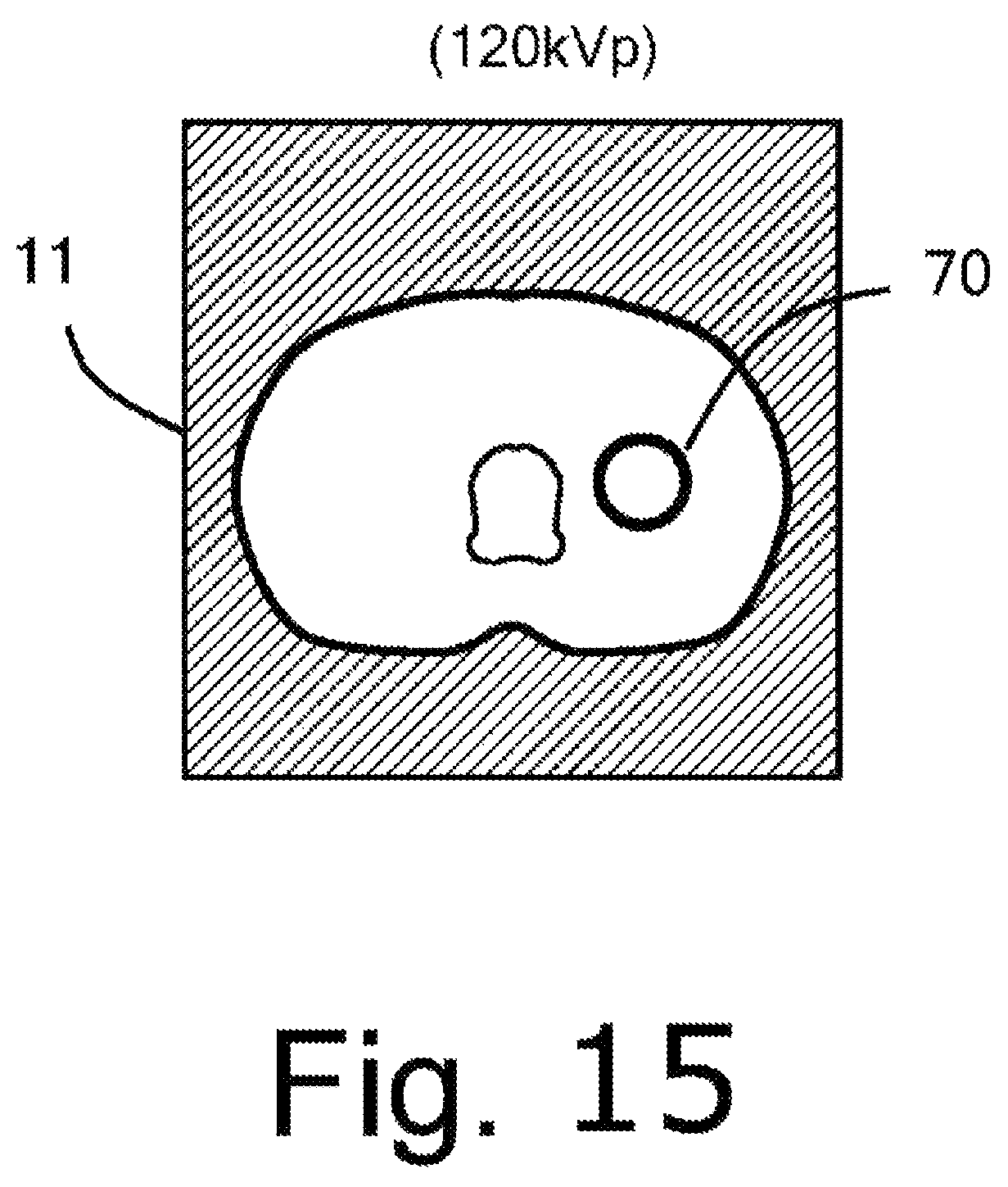 Patent US12569207 Figure 15 – Device for inferring virtual monochromatic x-ray image, CT system, method of creating trained neural network, and storage medium