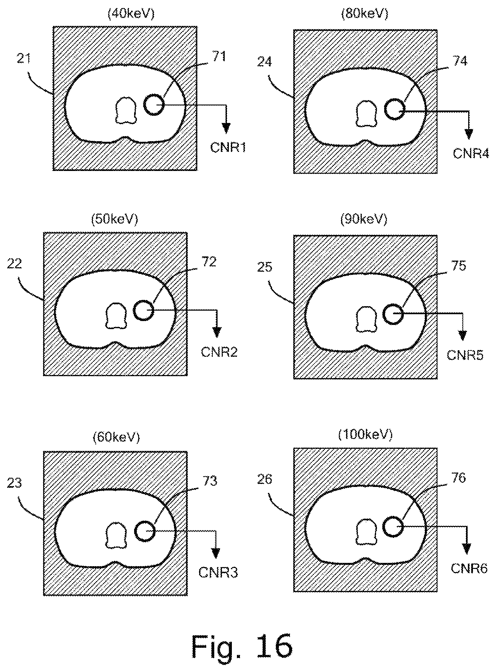 Patent US12569207 Figure 16 – Device for inferring virtual monochromatic x-ray image, CT system, method of creating trained neural network, and storage medium