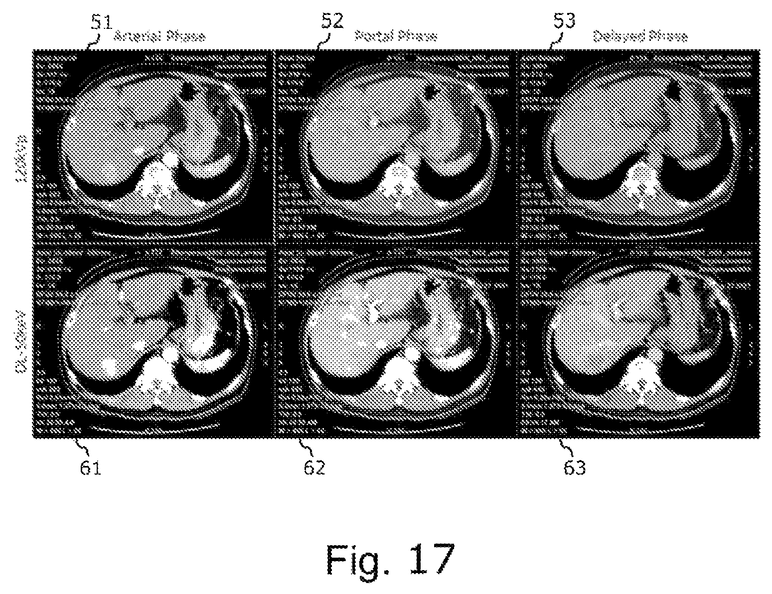 Patent US12569207 Figure 17 – Device for inferring virtual monochromatic x-ray image, CT system, method of creating trained neural network, and storage medium