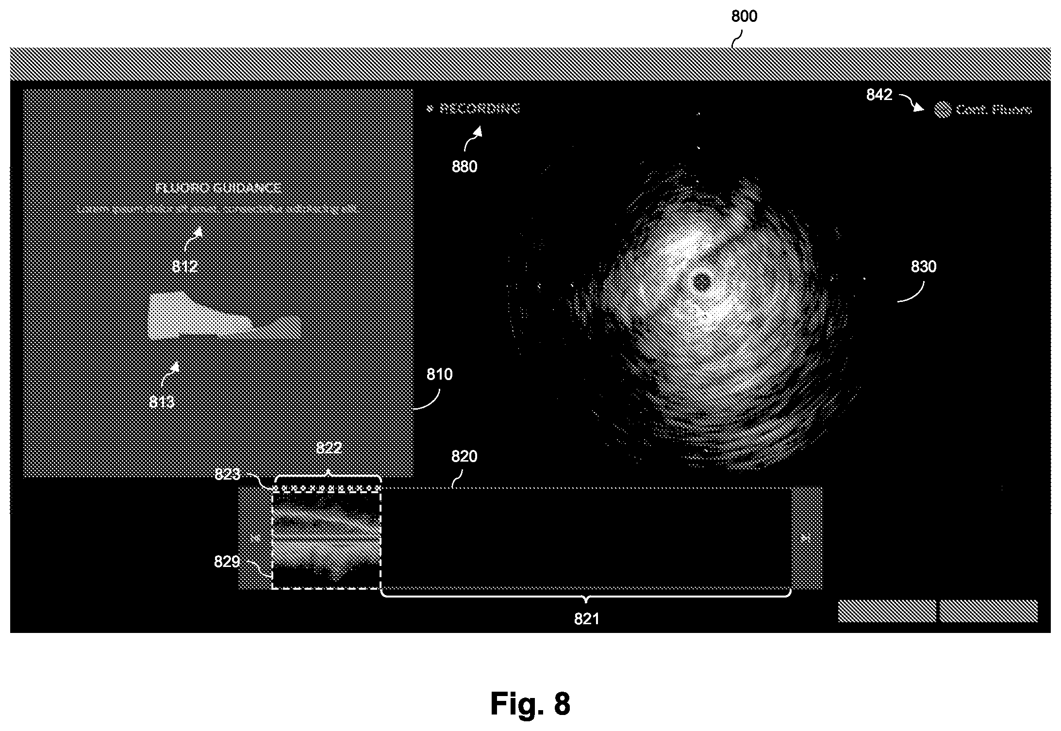 Patent US12569210 Figure 8 – Coregistration reliability with extraluminal image and intraluminal data