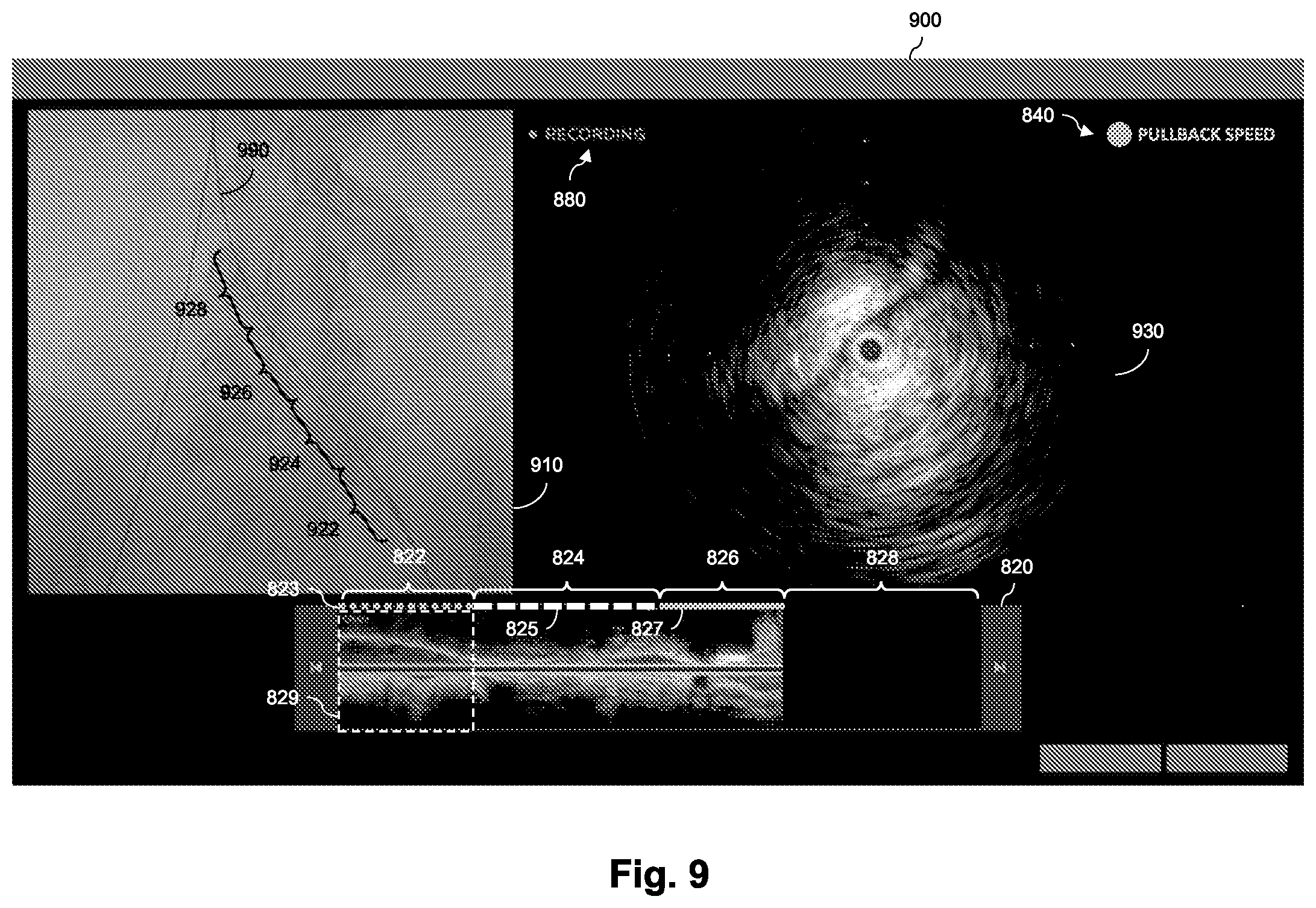 Patent US12569210 Figure 9 – Coregistration reliability with extraluminal image and intraluminal data
