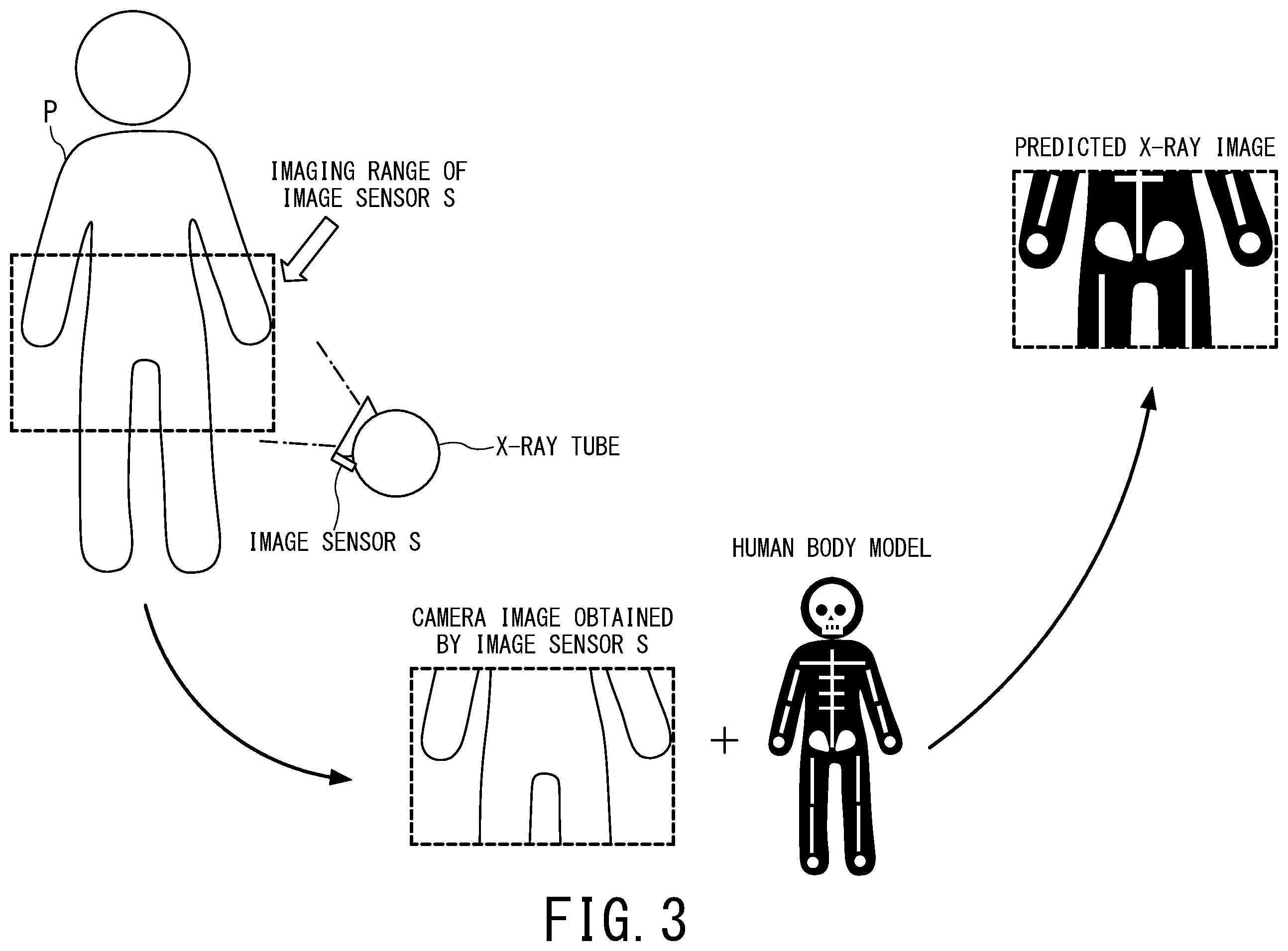 Patent US12569211 Figure 3 – X-ray diagnostic apparatus and image processing method