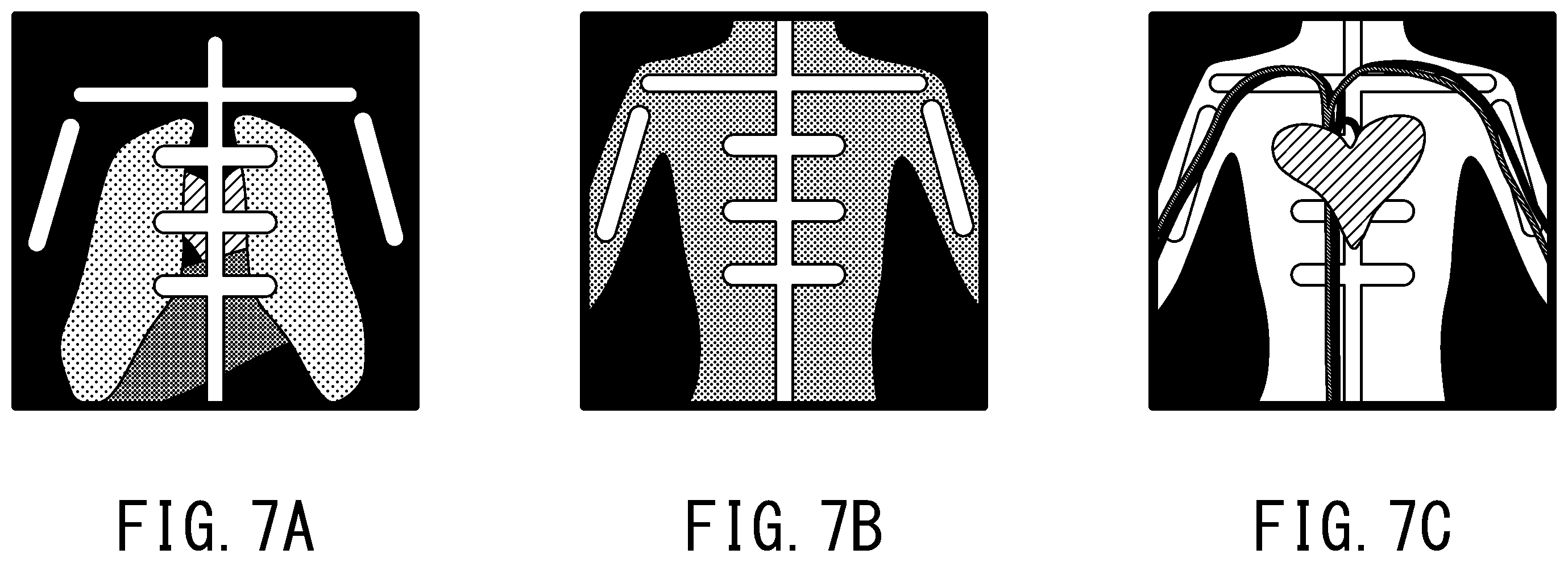 Patent US12569211 Figure 7 – X-ray diagnostic apparatus and image processing method