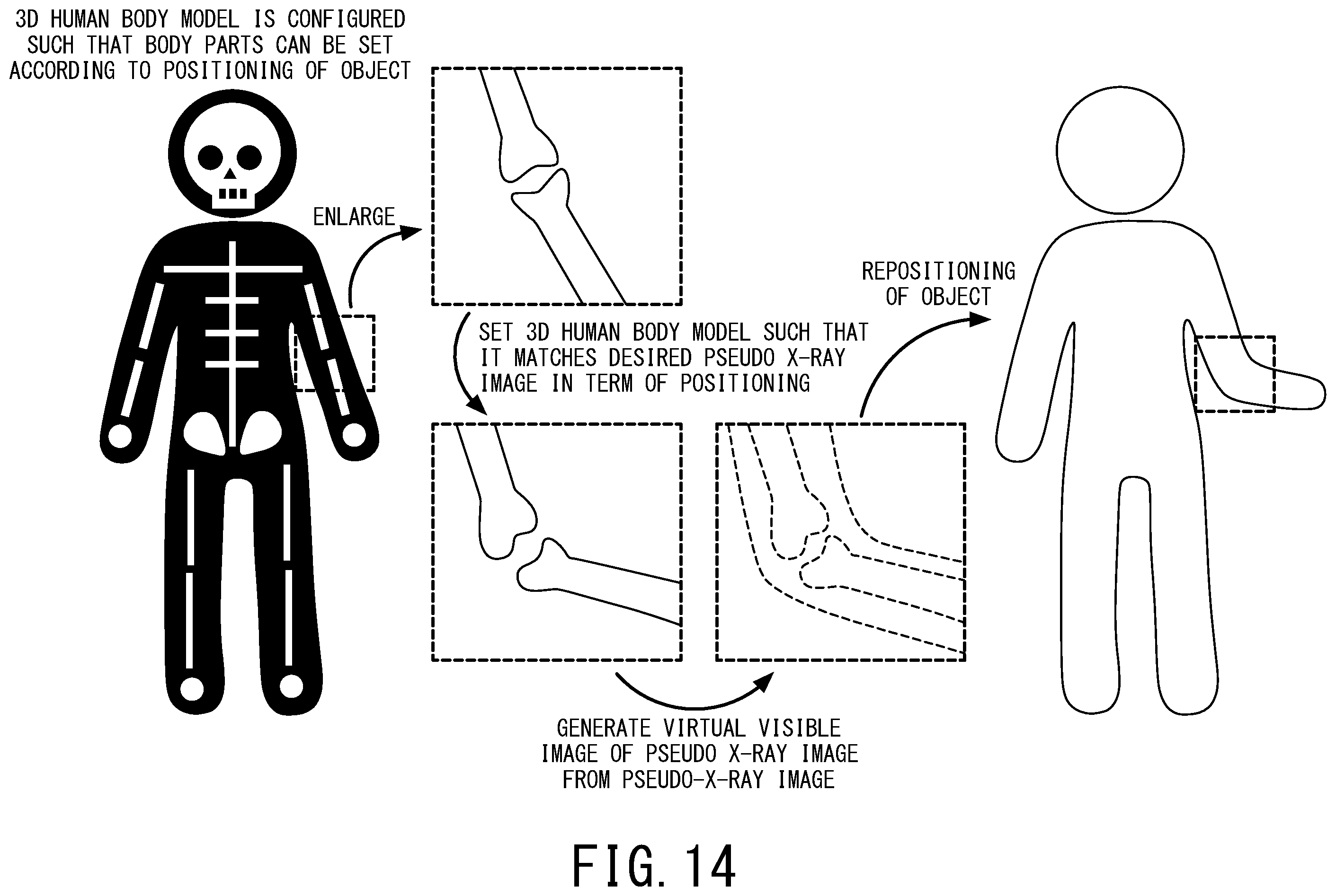 Patent US12569211 Figure 14 – X-ray diagnostic apparatus and image processing method