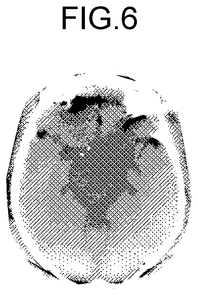 Patent US12569212 Figure 4 – Medical image processing apparatus, x-ray diagnostic apparatus, and medical image processing method