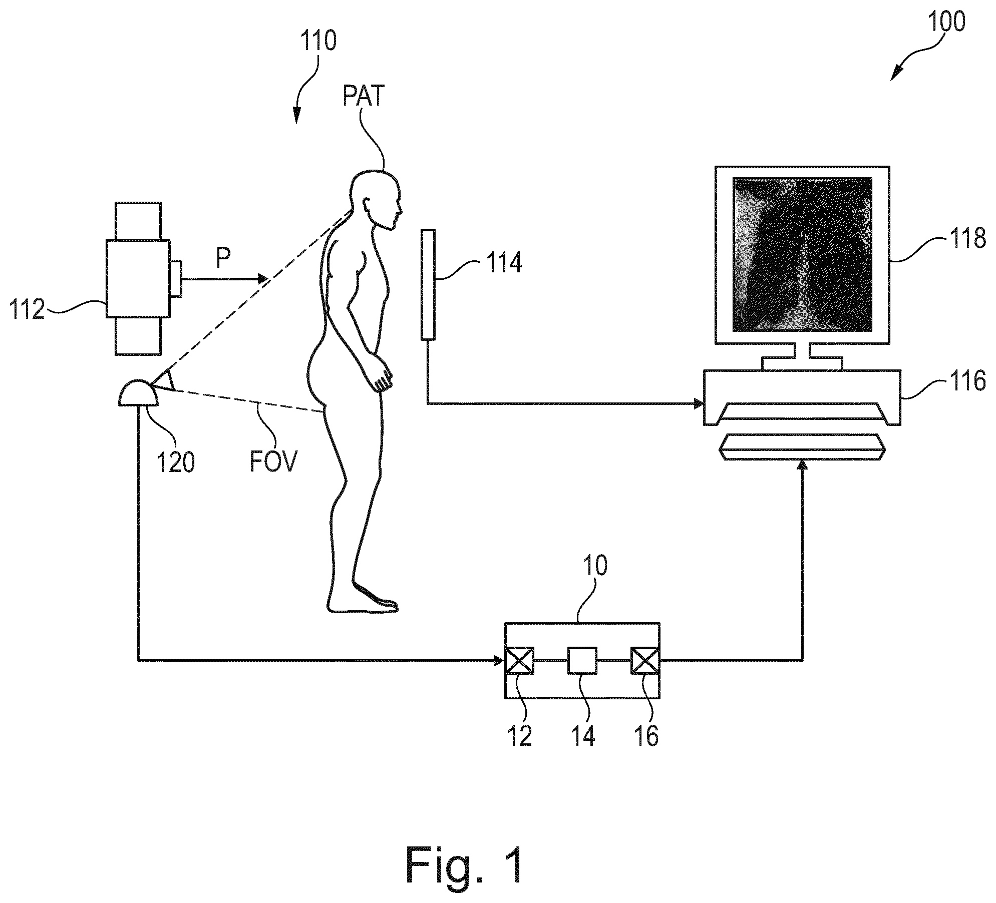 Patent US12569214 Figure 1 – Contactless measurement and visualization of respiration for chest radiography image examinations