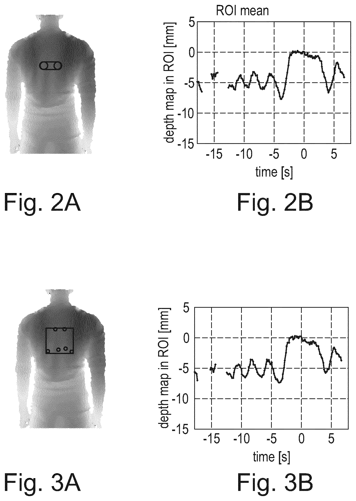 Patent US12569214 Figure 2 – Contactless measurement and visualization of respiration for chest radiography image examinations