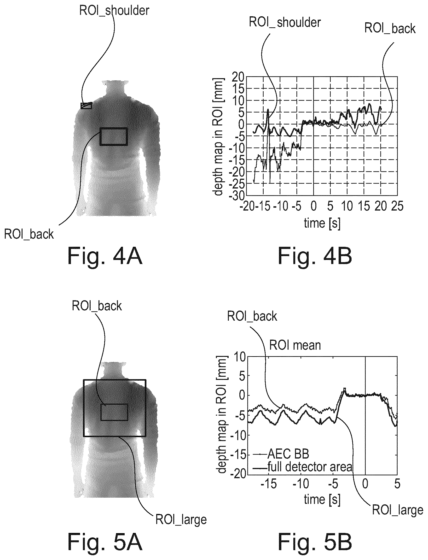 Patent US12569214 Figure 3 – Contactless measurement and visualization of respiration for chest radiography image examinations