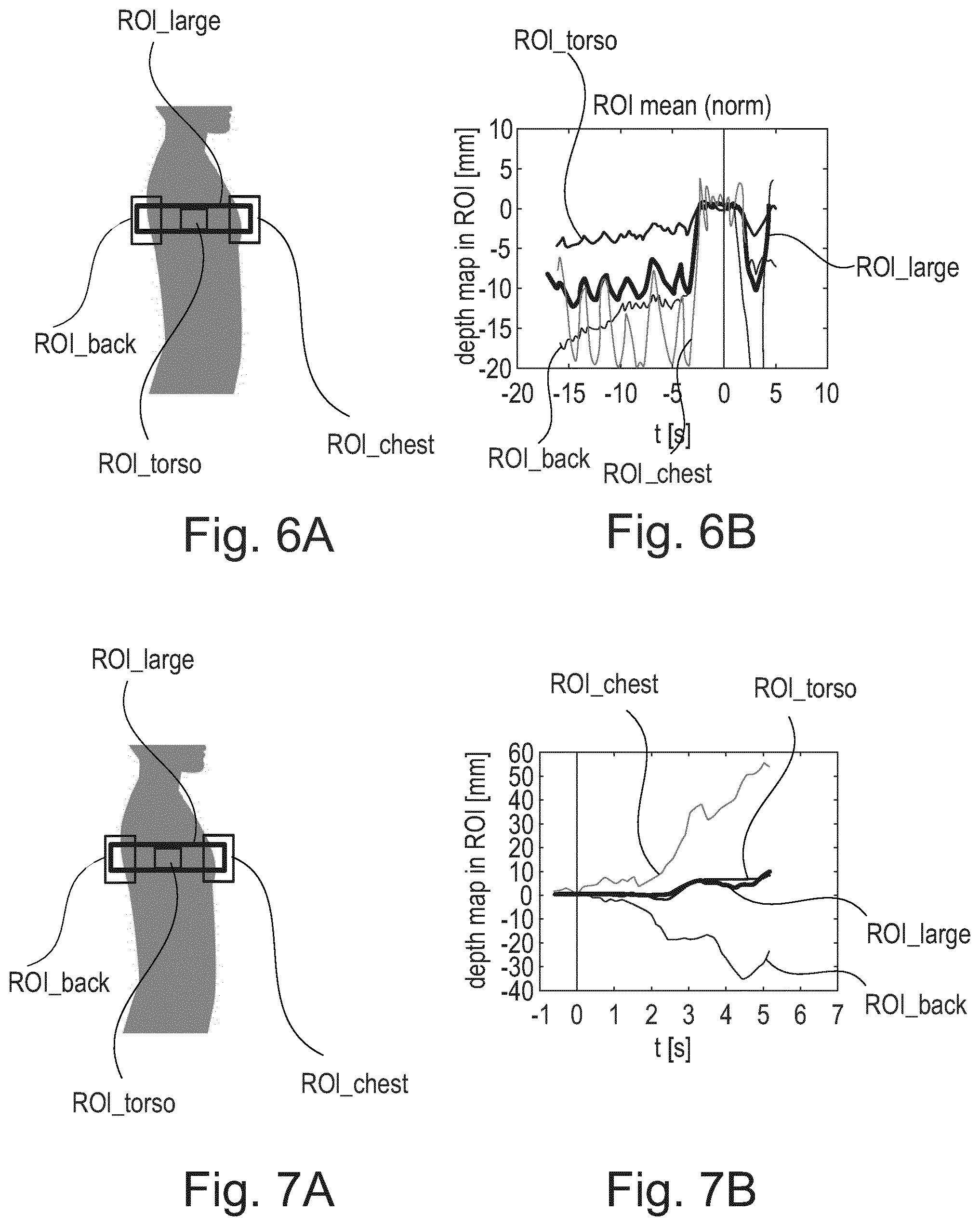 Patent US12569214 Figure 4 – Contactless measurement and visualization of respiration for chest radiography image examinations