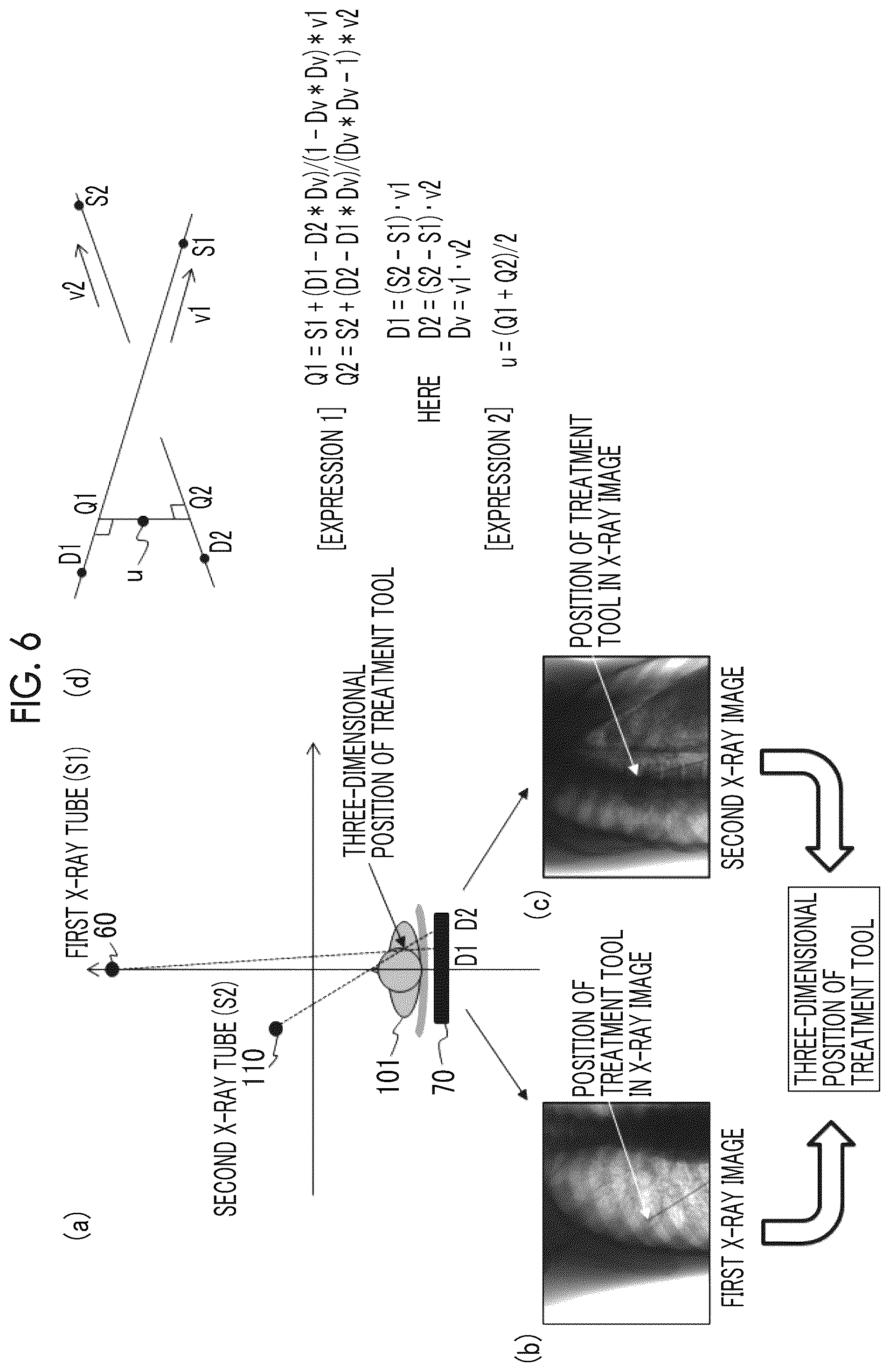 Patent US12569217 Figure 6 – X-ray imaging apparatus and X-ray imaging method
