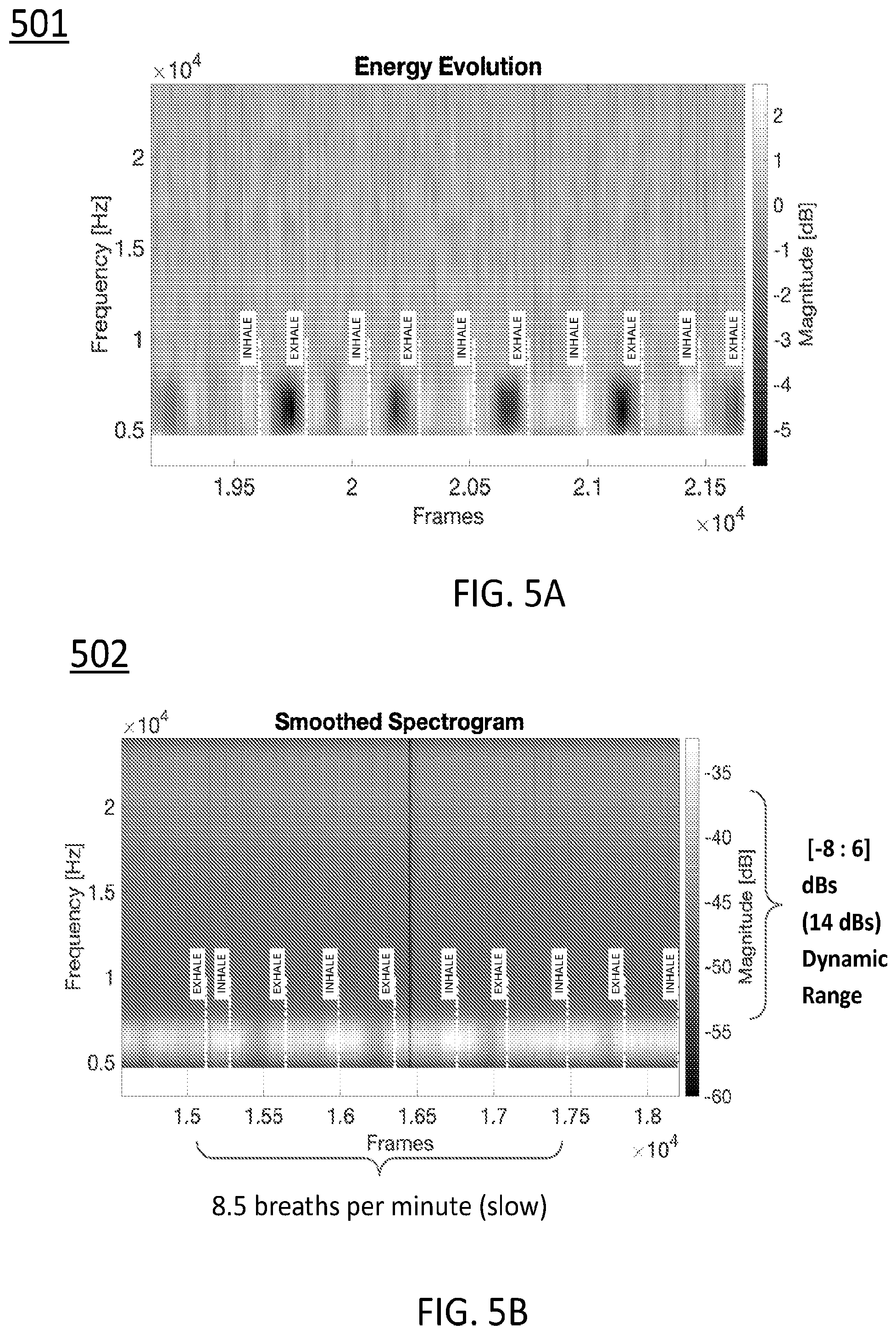 Patent US12569218 Figure 14 – Systems, devices, and methods for performing active auscultation and detecting acoustic signals and/or sonic energy measurements