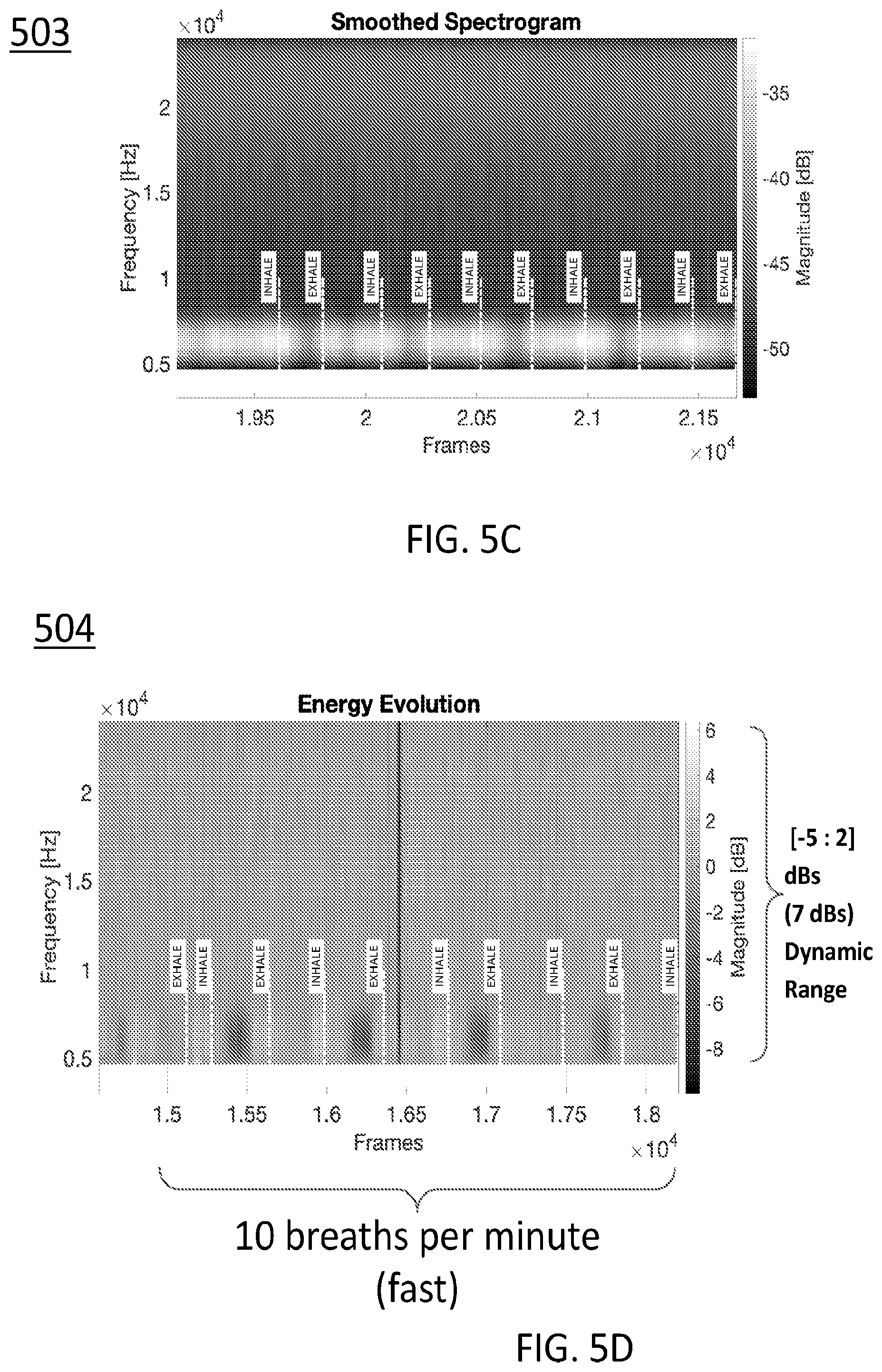 Patent US12569218 Figure 15 – Systems, devices, and methods for performing active auscultation and detecting acoustic signals and/or sonic energy measurements