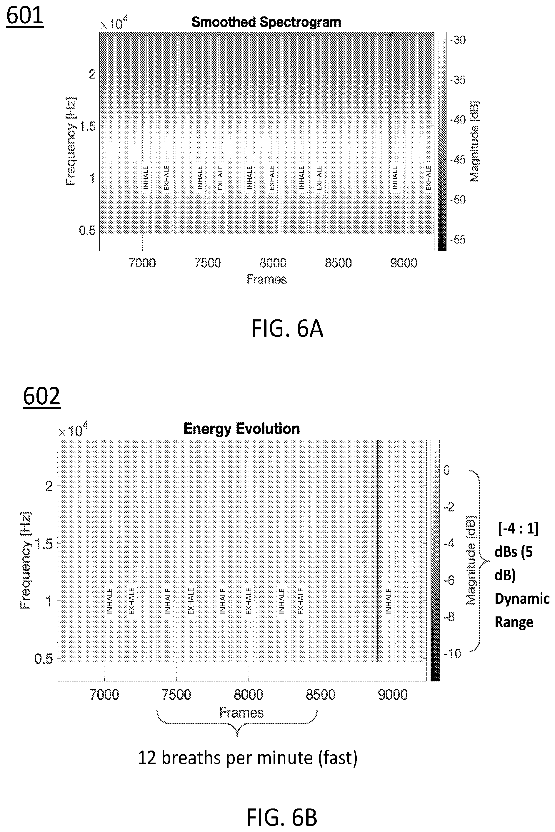 Patent US12569218 Figure 16 – Systems, devices, and methods for performing active auscultation and detecting acoustic signals and/or sonic energy measurements