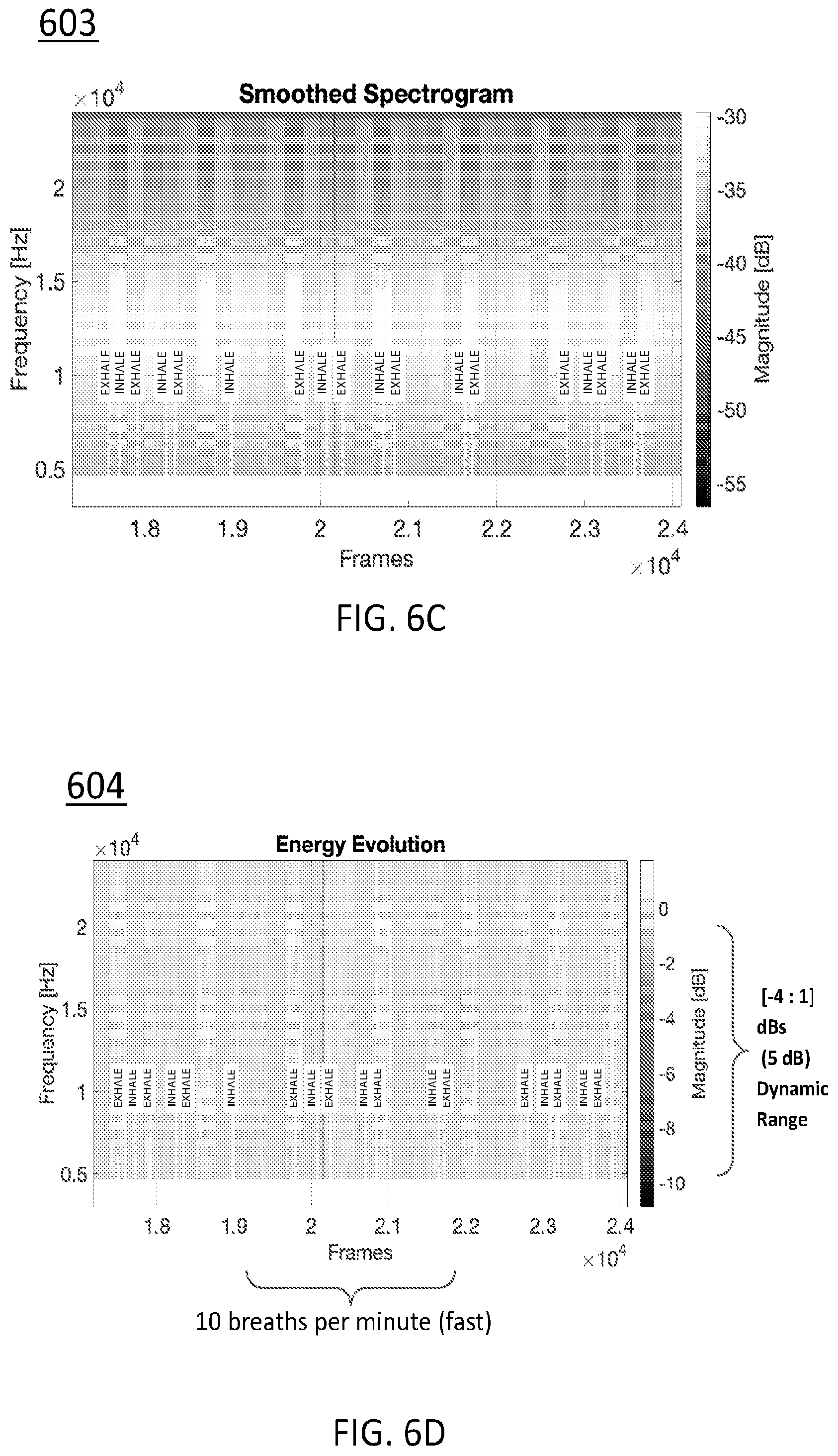 Patent US12569218 Figure 17 – Systems, devices, and methods for performing active auscultation and detecting acoustic signals and/or sonic energy measurements