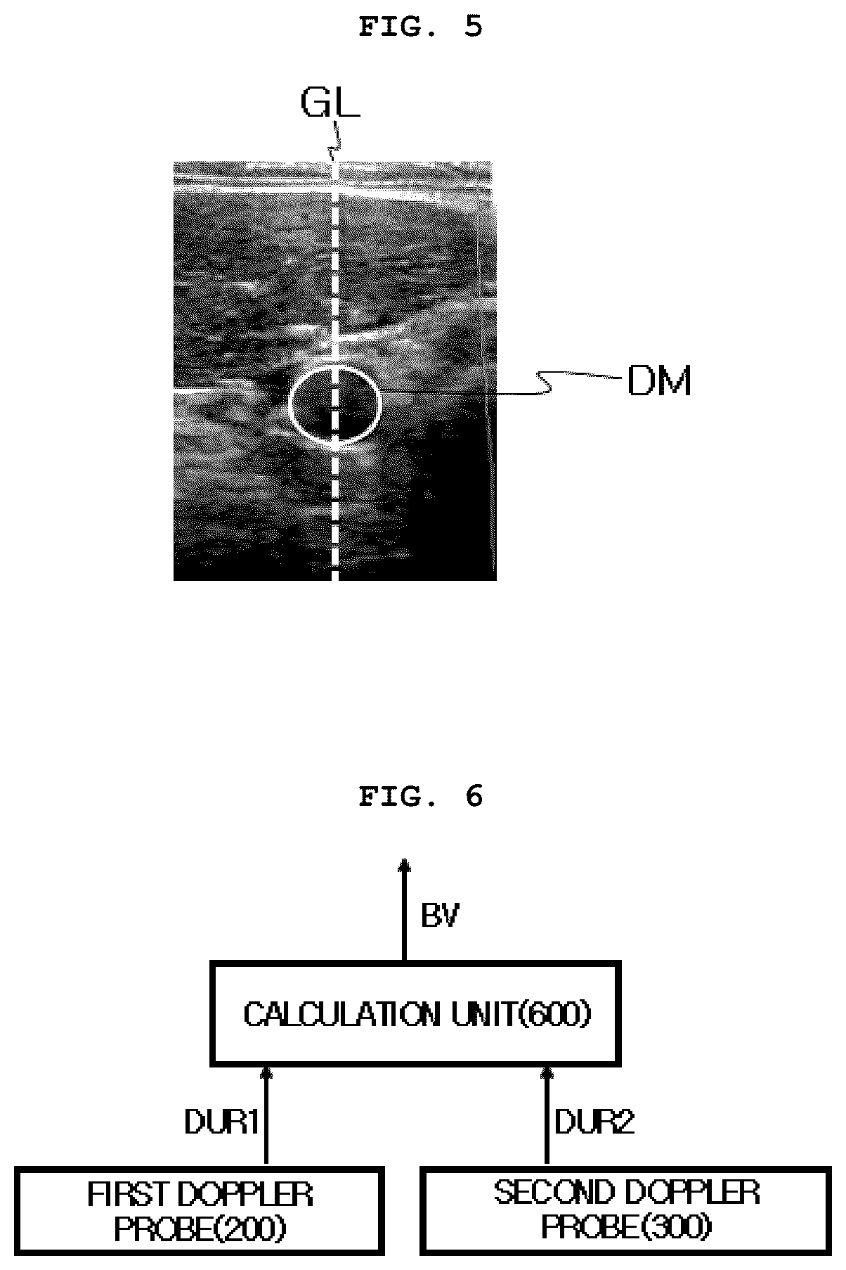 Patent US12569220 Figure 3 – Blood flow measurement system