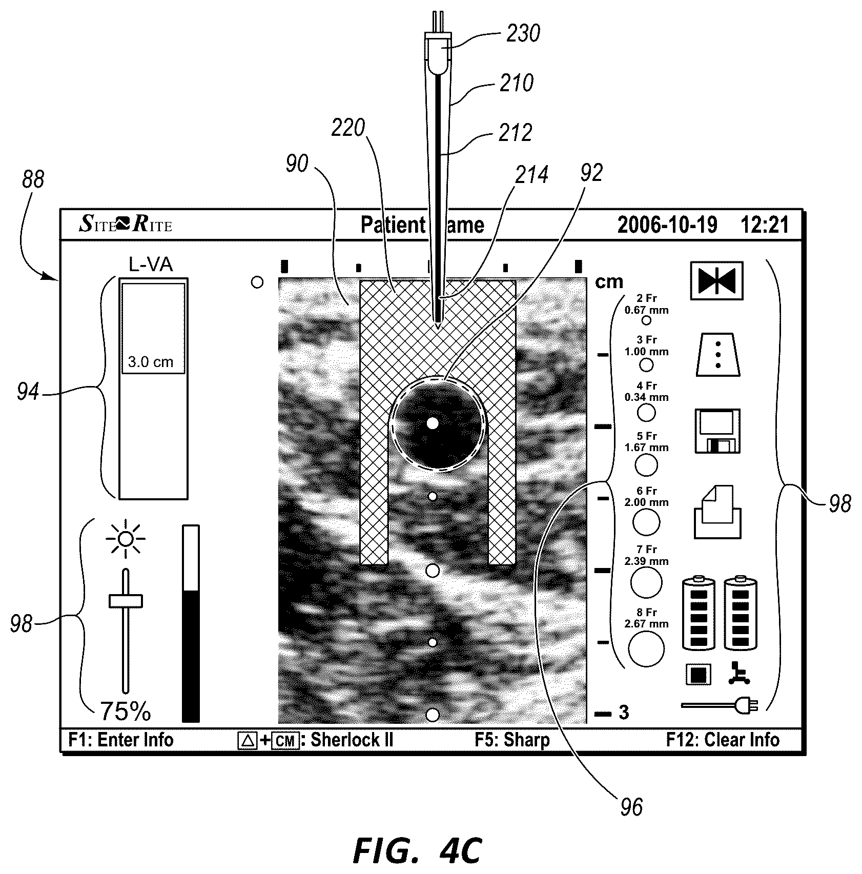 Patent US12569221 Figure 4 – Systems and methods for infrared-enhanced ultrasound visualization