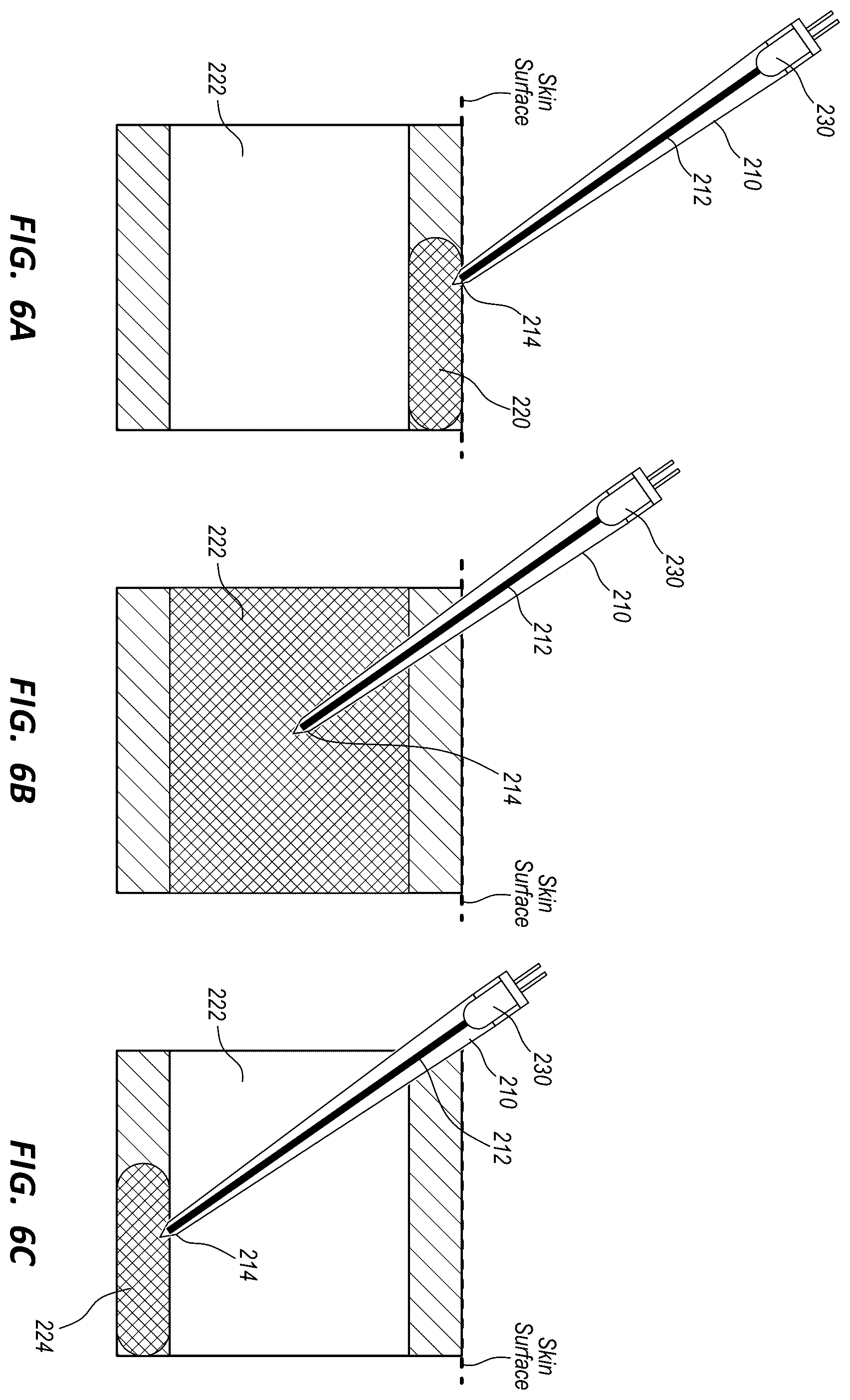 Patent US12569221 Figure 6 – Systems and methods for infrared-enhanced ultrasound visualization