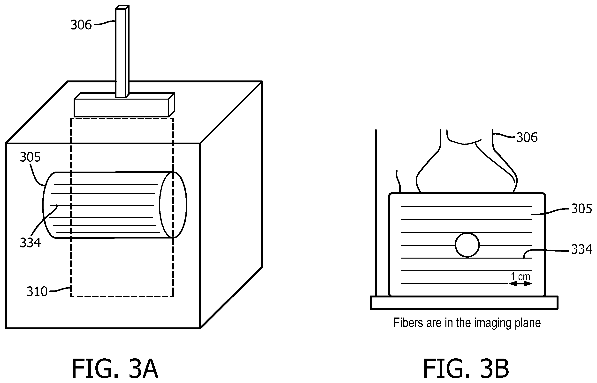 Patent US12569226 Figure 3 – Ultrasound system and method for guided shear wave elastography of anisotropic tissue