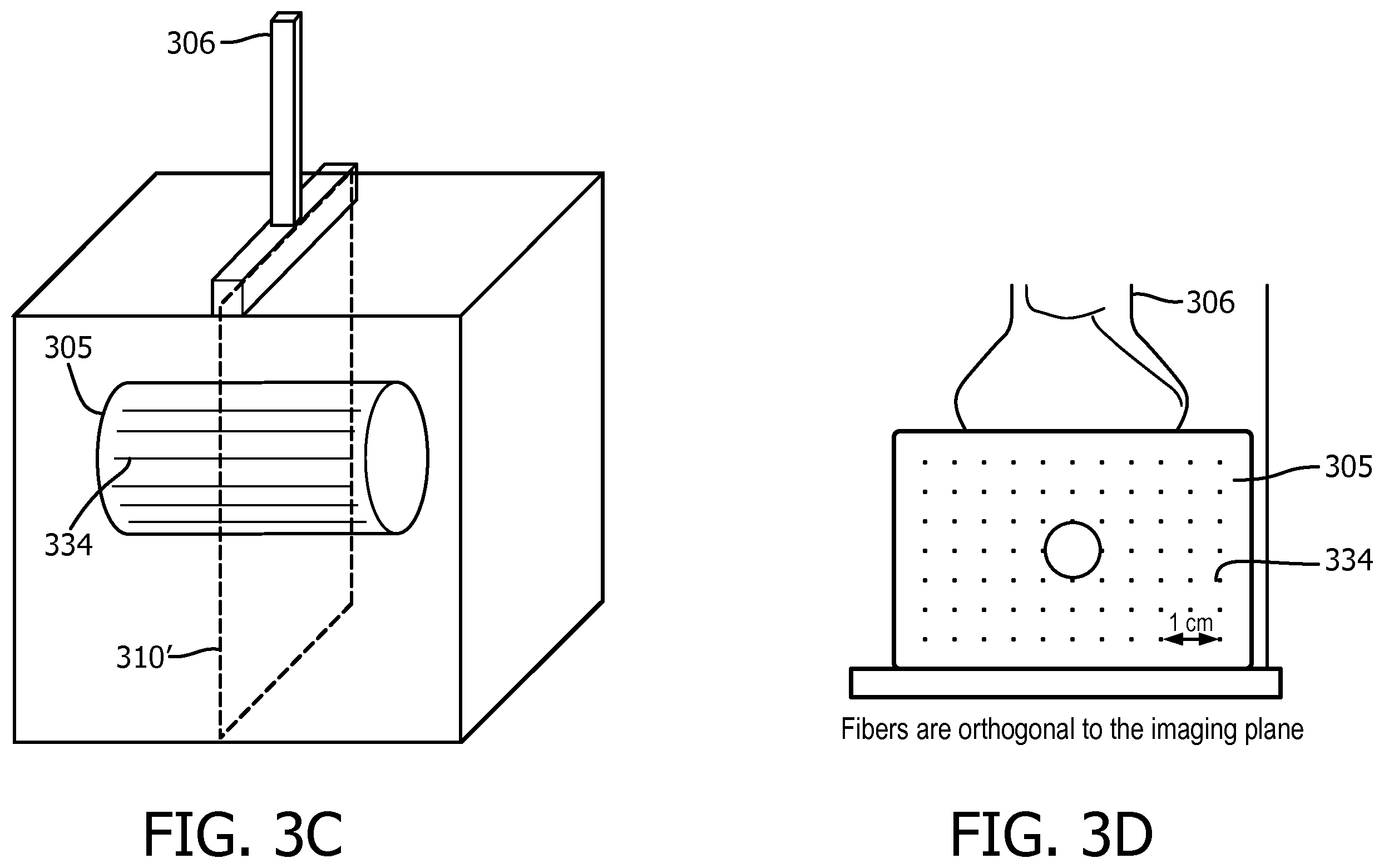 Patent US12569226 Figure 4 – Ultrasound system and method for guided shear wave elastography of anisotropic tissue