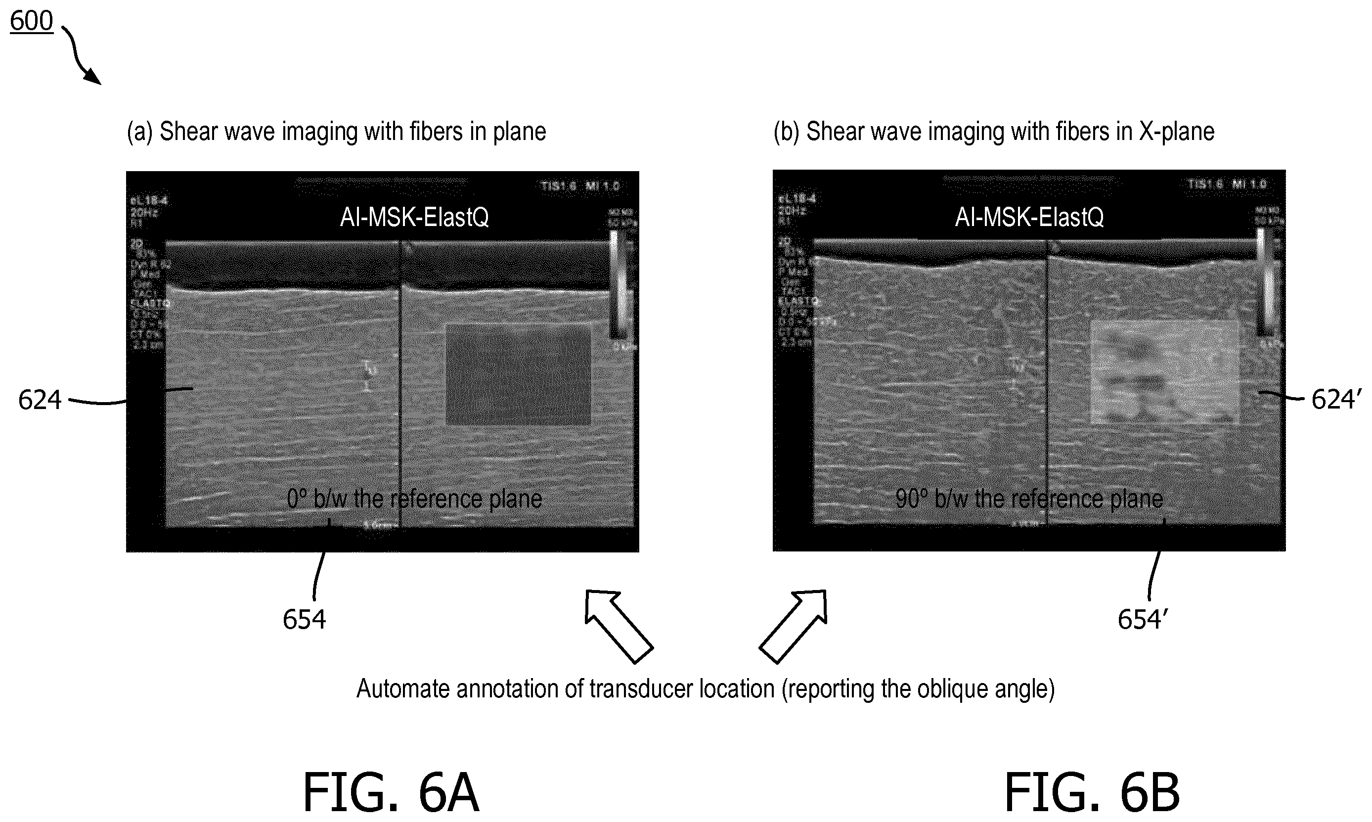 Patent US12569226 Figure 10 – Ultrasound system and method for guided shear wave elastography of anisotropic tissue