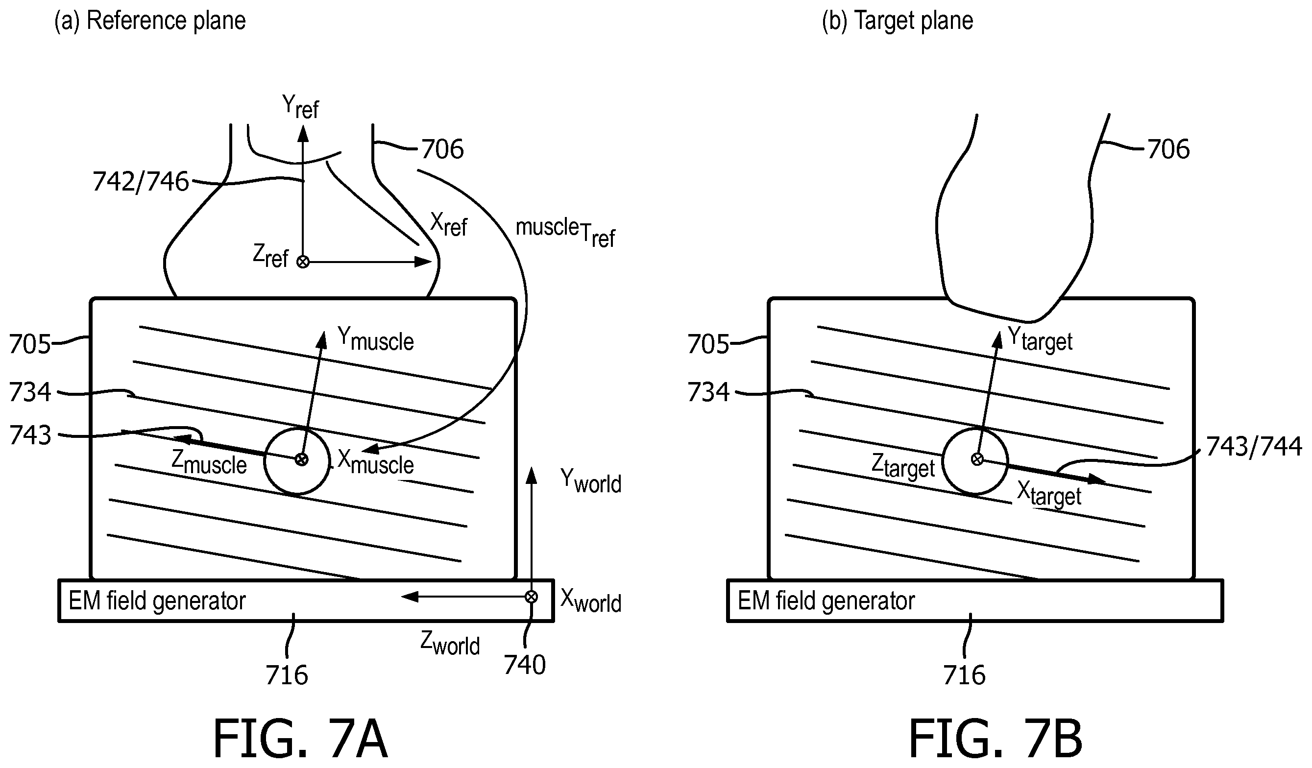 Patent US12569226 Figure 11 – Ultrasound system and method for guided shear wave elastography of anisotropic tissue