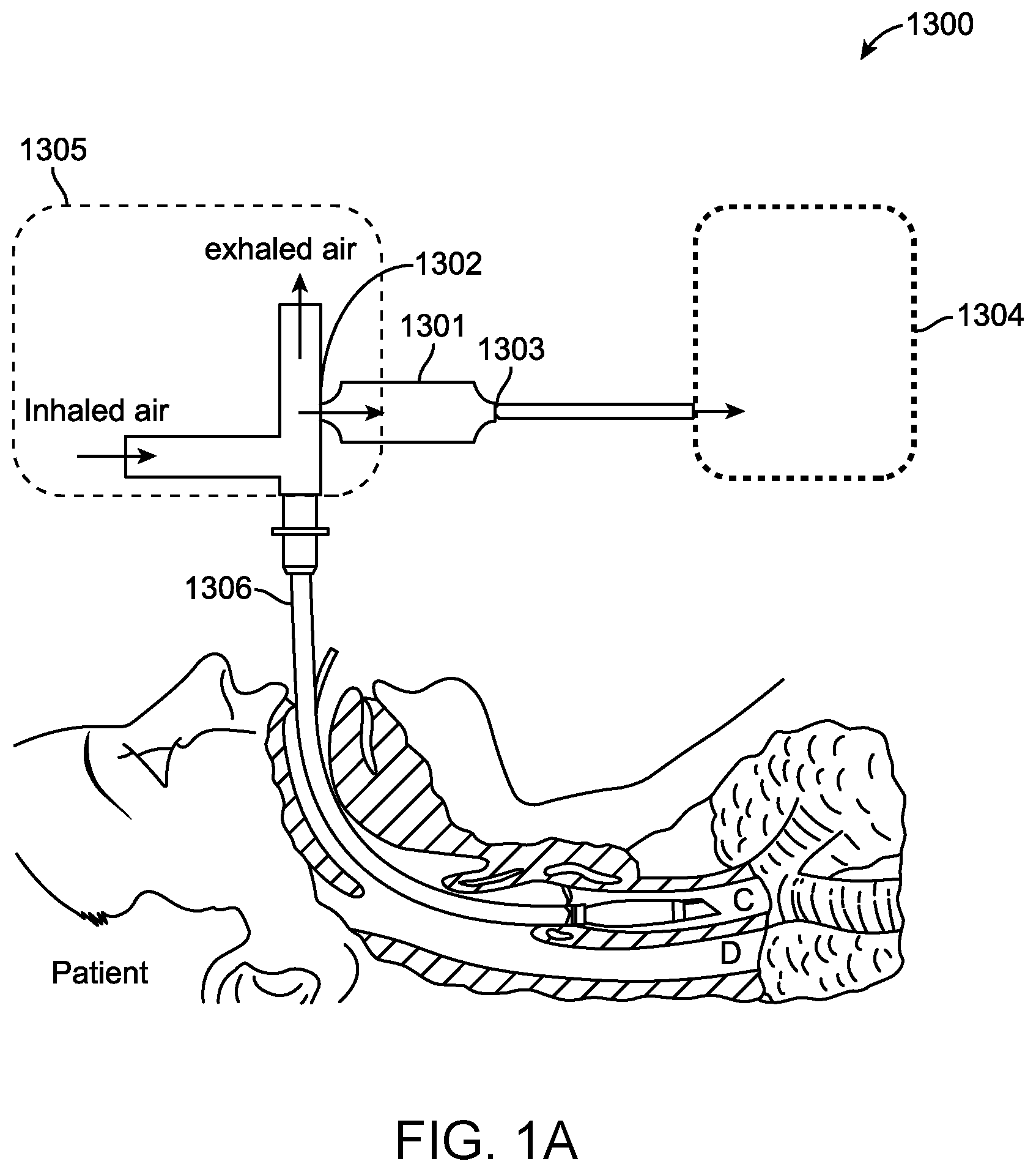 Patent US12569229 Figure 1 – Capturing truncated proteoforms in exhaled breath for diagnosis and treatment of diseases