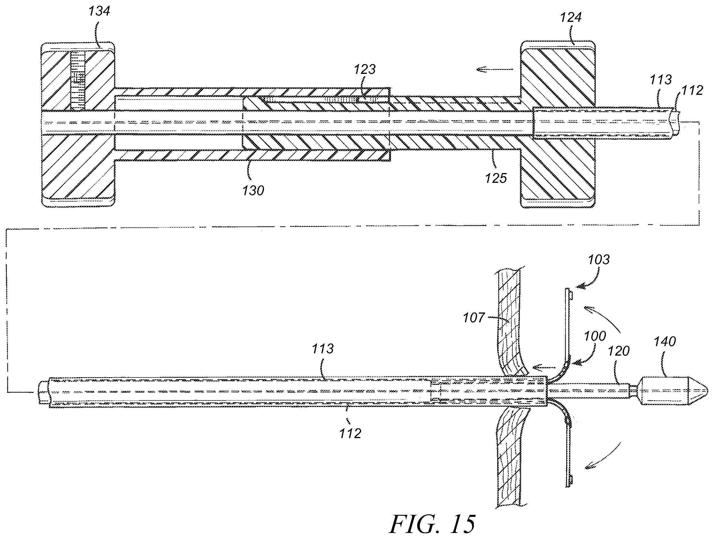 Patent US12569233 Figure 14 – Devices and methods for coronary sinus pressure relief