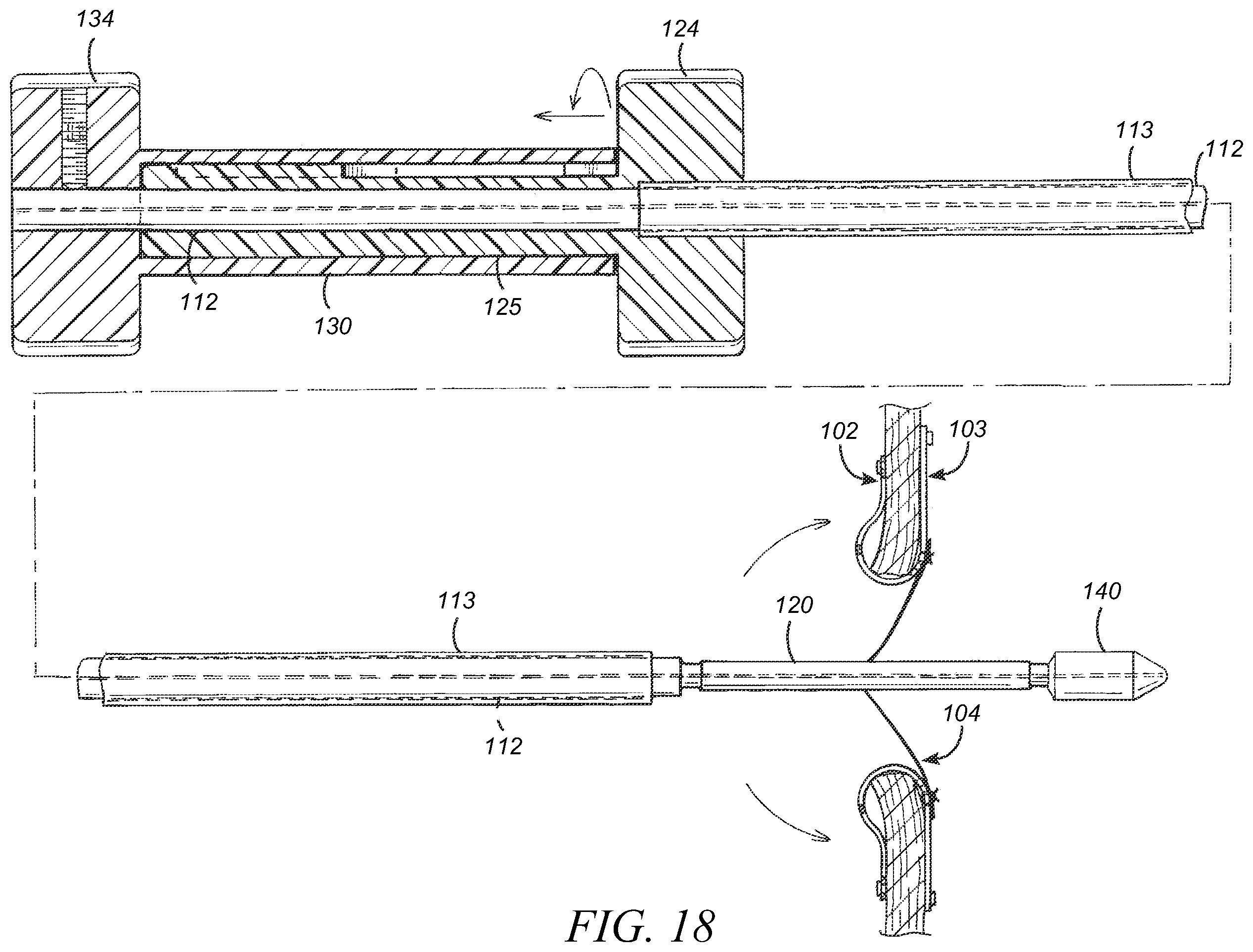 Patent US12569233 Figure 17 – Devices and methods for coronary sinus pressure relief