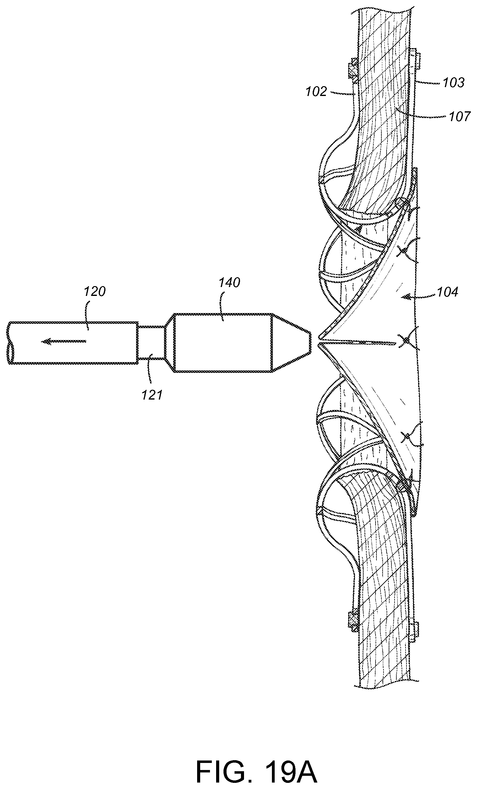 Patent US12569233 Figure 18 – Devices and methods for coronary sinus pressure relief