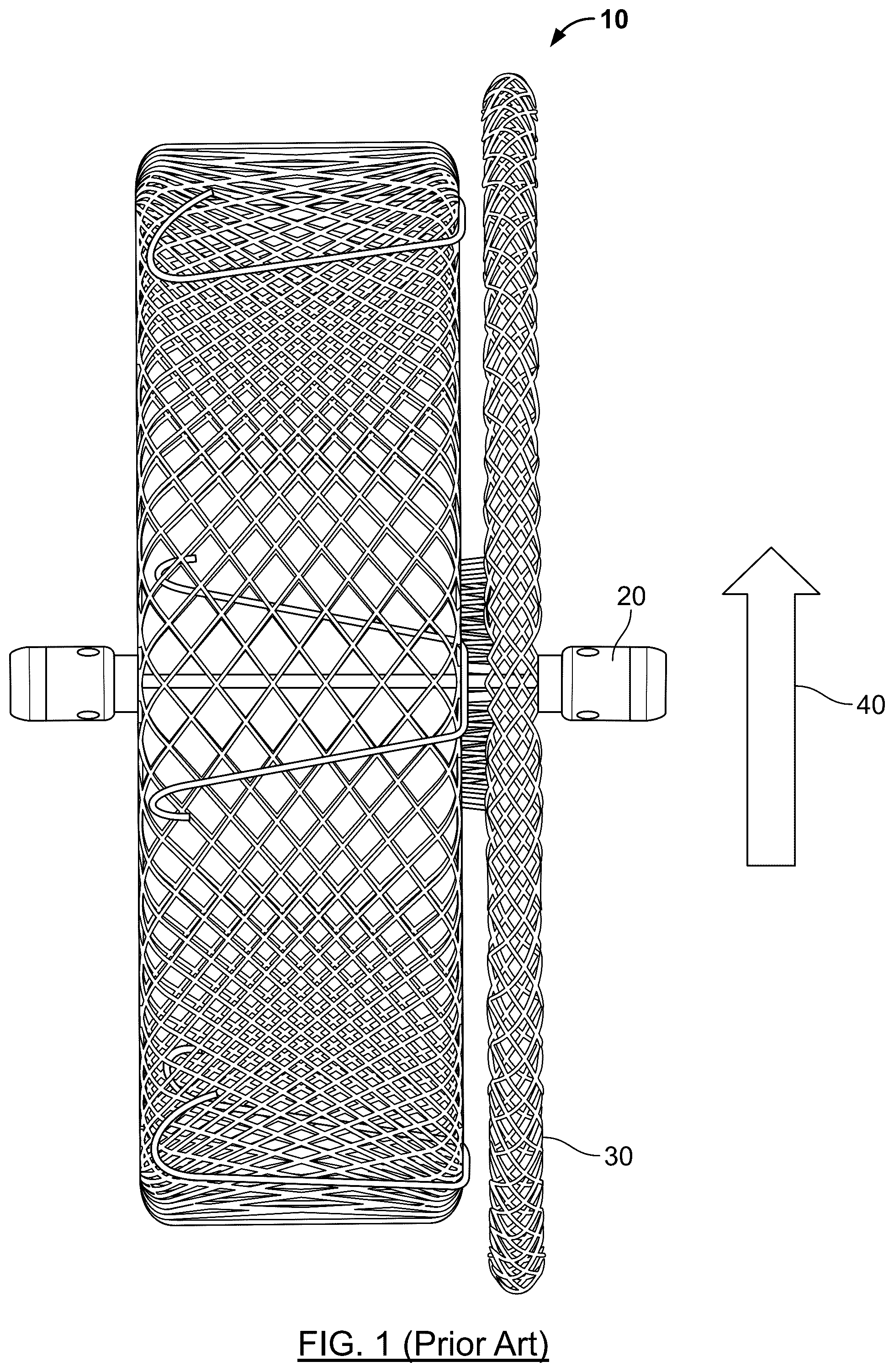 Patent US12569234 Figure 1 – Devices and methods for occluding abnormal openings in a patient's vasculature