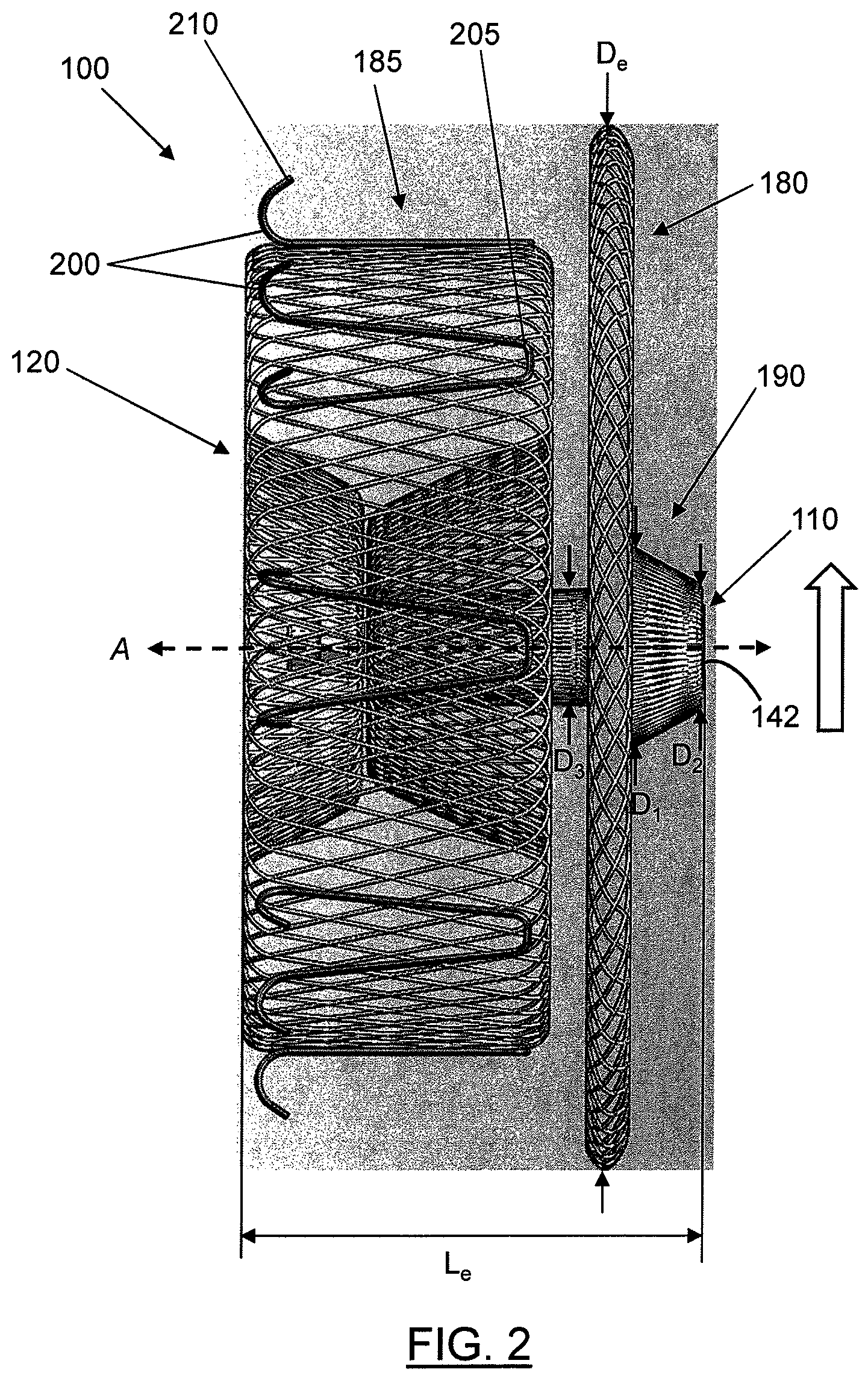 Patent US12569234 Figure 2 – Devices and methods for occluding abnormal openings in a patient's vasculature