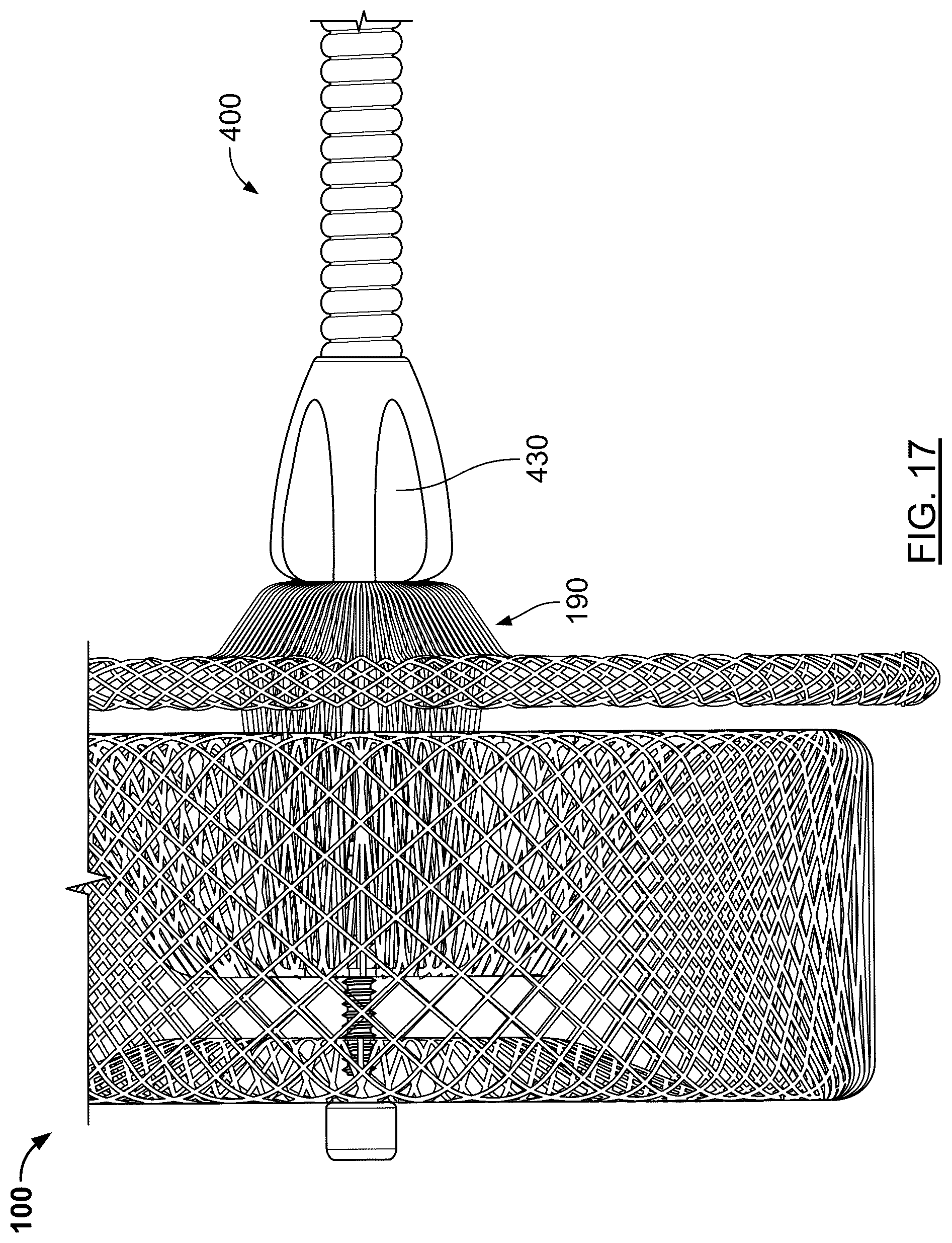 Patent US12569234 Figure 18 – Devices and methods for occluding abnormal openings in a patient's vasculature