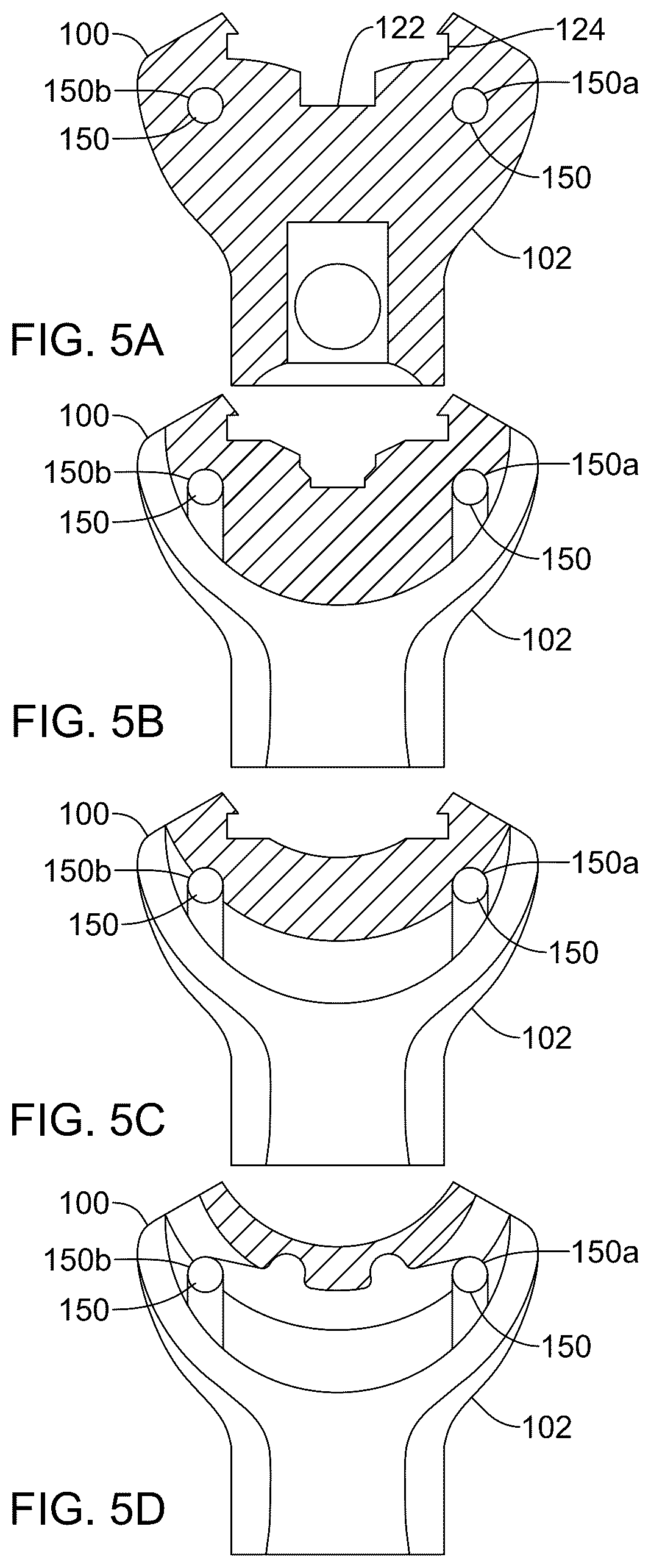 Patent US12569236 Figure 4 – Devices, systems, and methods for inserting and removing surgical wires