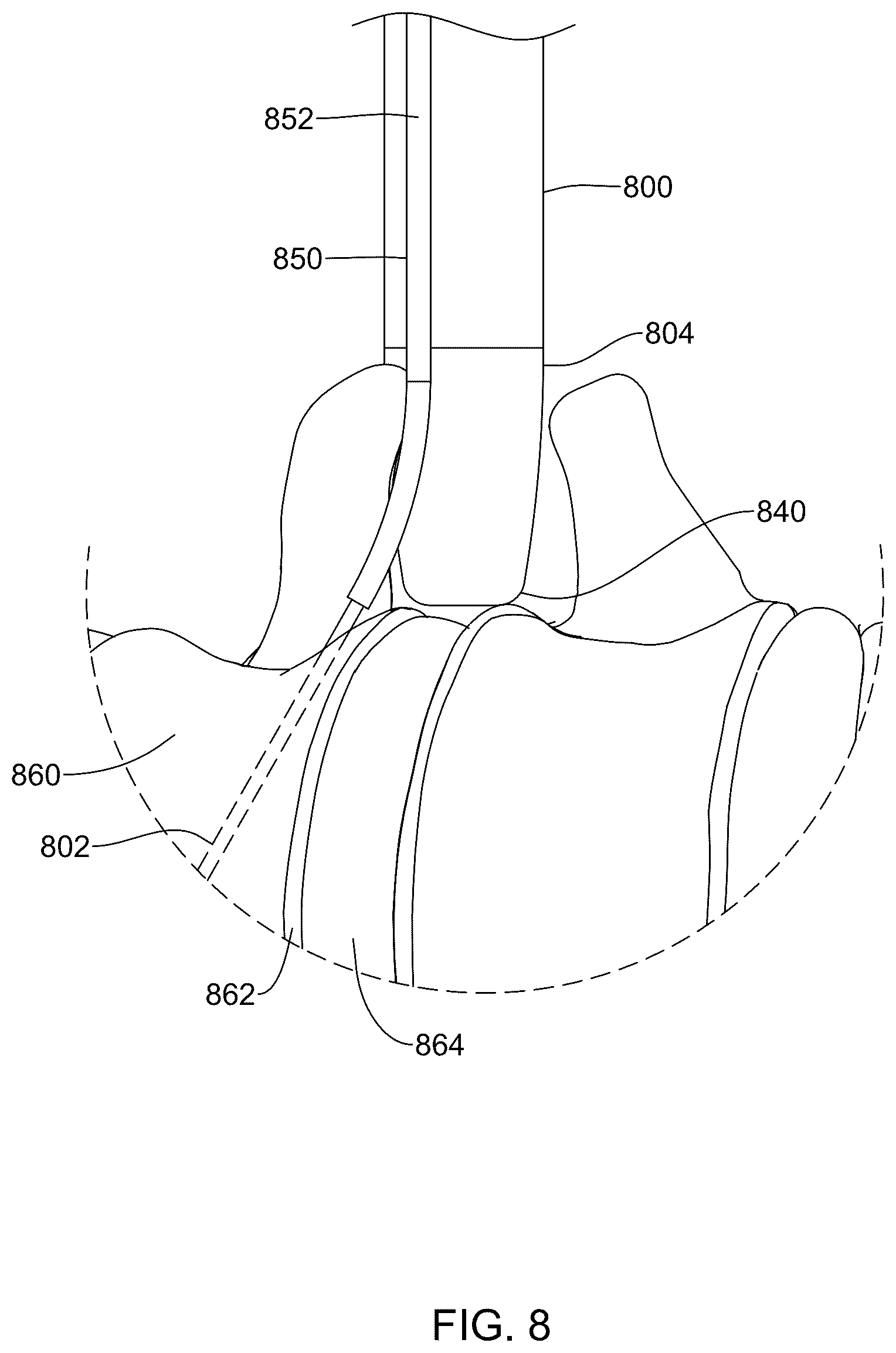 Patent US12569236 Figure 7 – Devices, systems, and methods for inserting and removing surgical wires