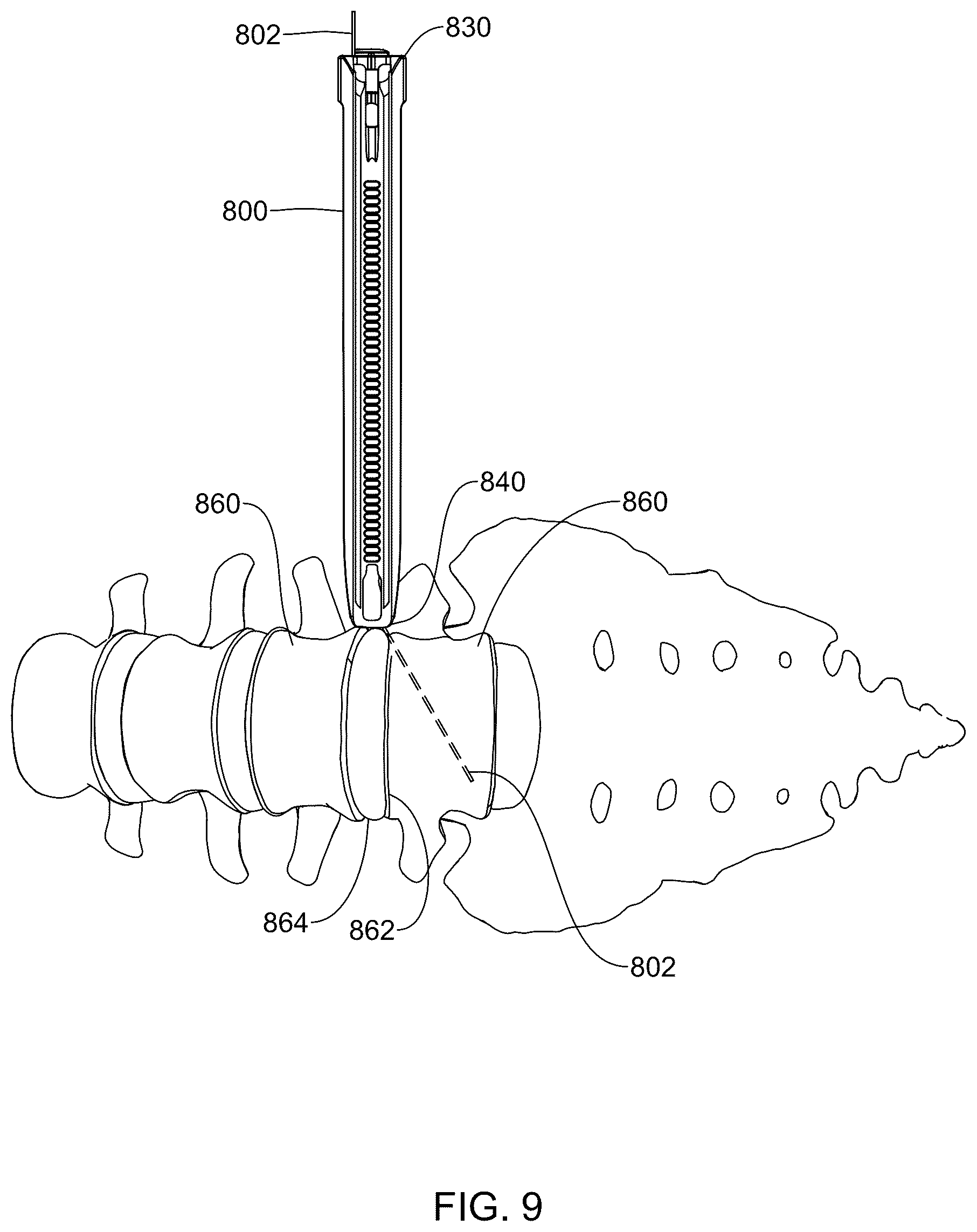 Patent US12569236 Figure 8 – Devices, systems, and methods for inserting and removing surgical wires