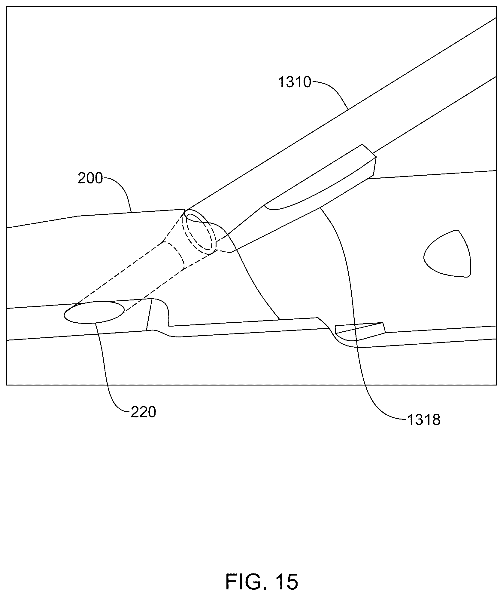 Patent US12569236 Figure 14 – Devices, systems, and methods for inserting and removing surgical wires