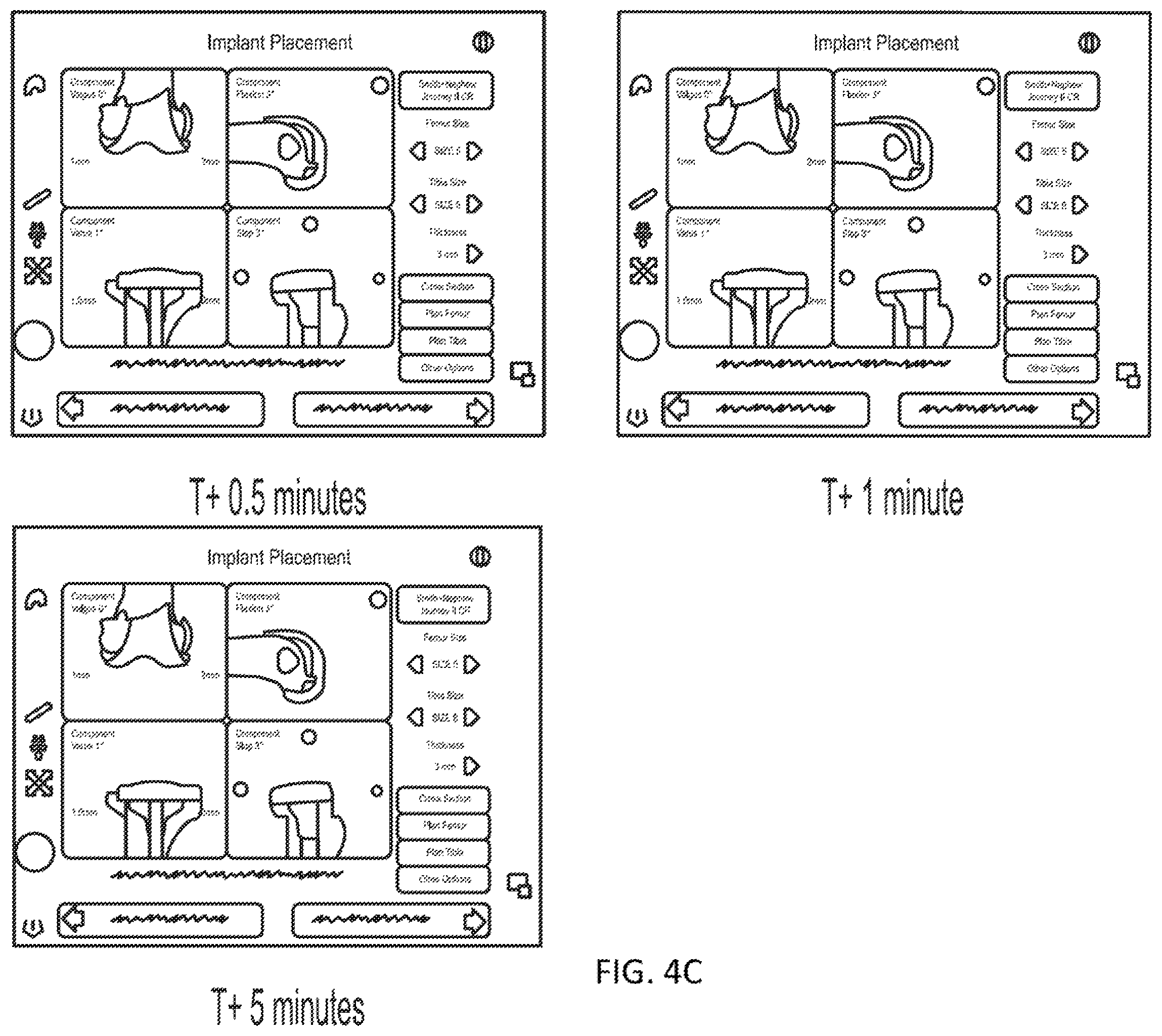 Patent US12569237 Figure 8 – Force-indicating retractor device and methods of use