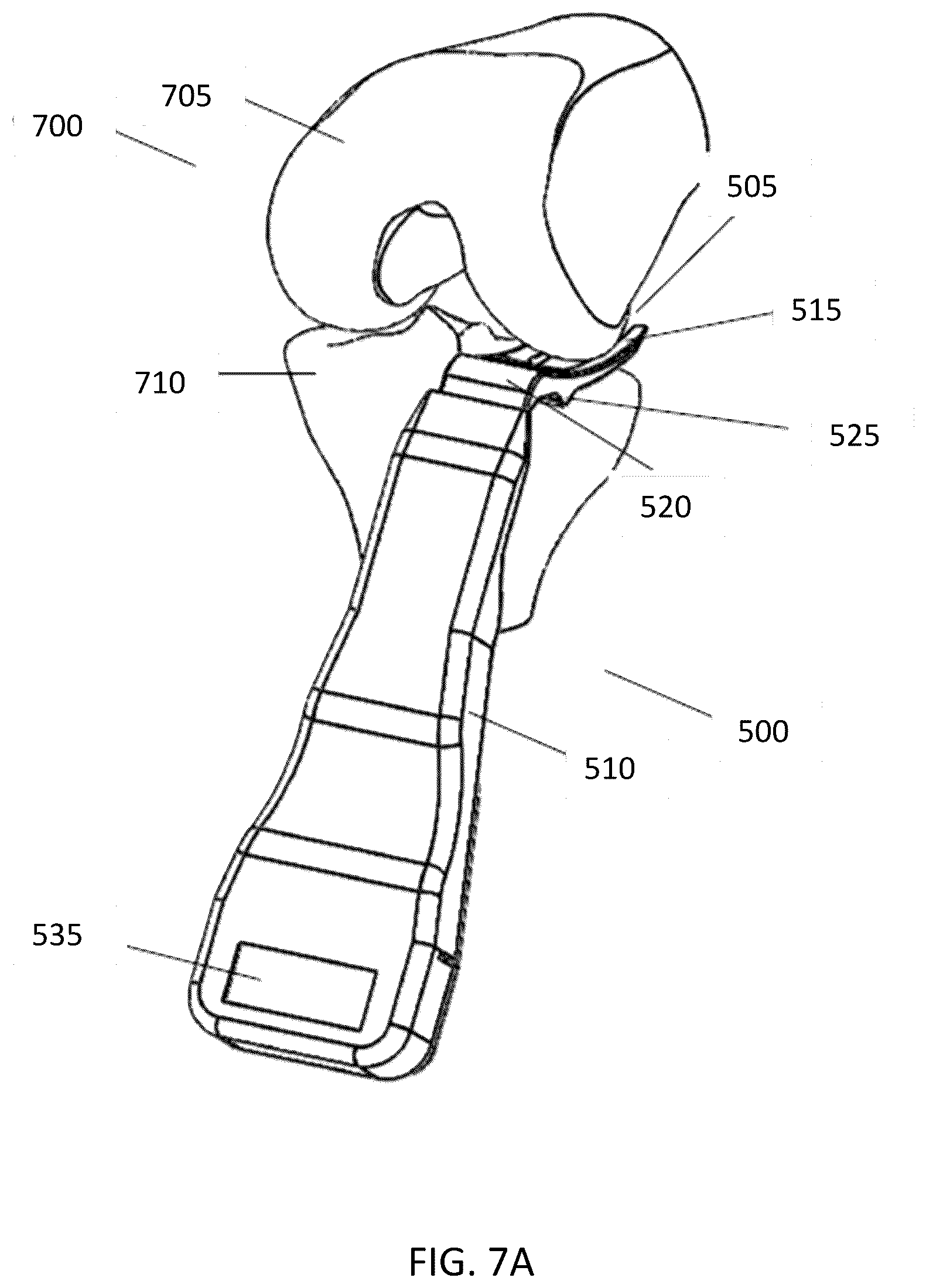 Patent US12569237 Figure 17 – Force-indicating retractor device and methods of use