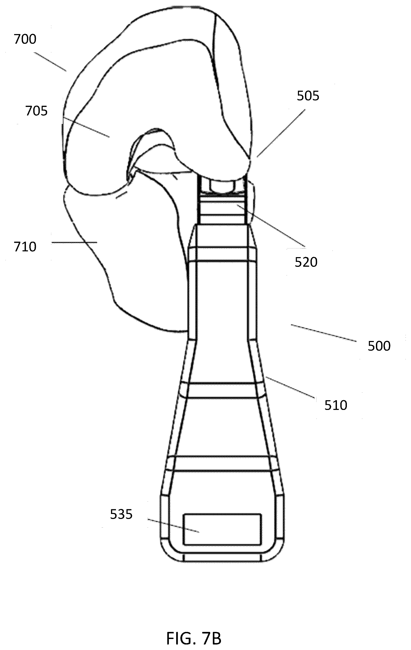 Patent US12569237 Figure 18 – Force-indicating retractor device and methods of use