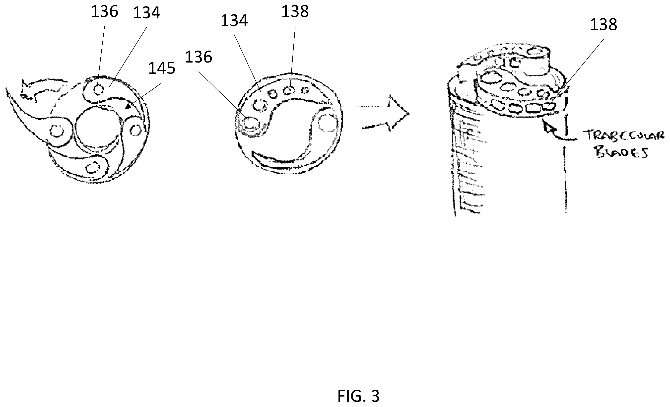 Patent US12569240 Figure 4 – Decorticating screw