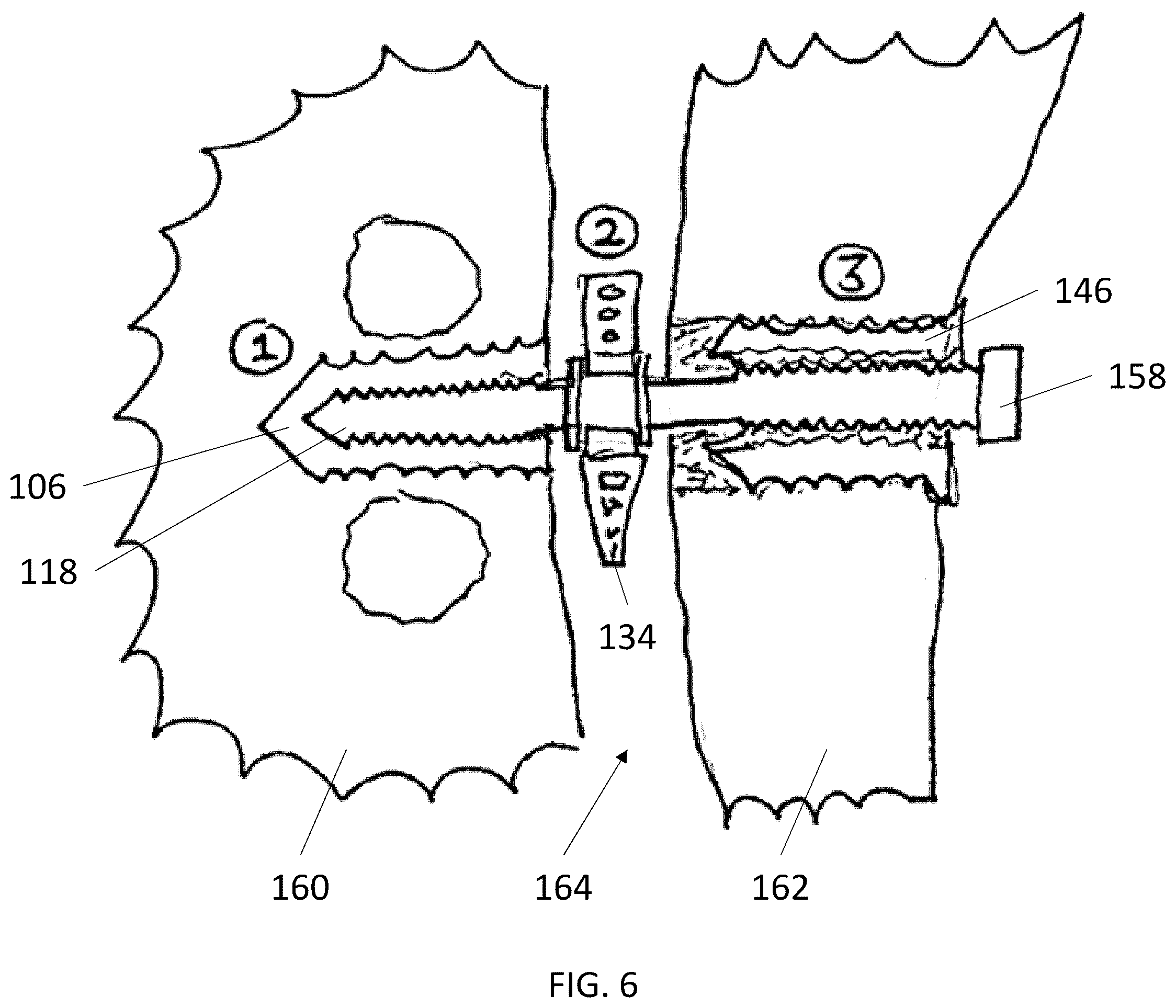 Patent US12569240 Figure 7 – Decorticating screw