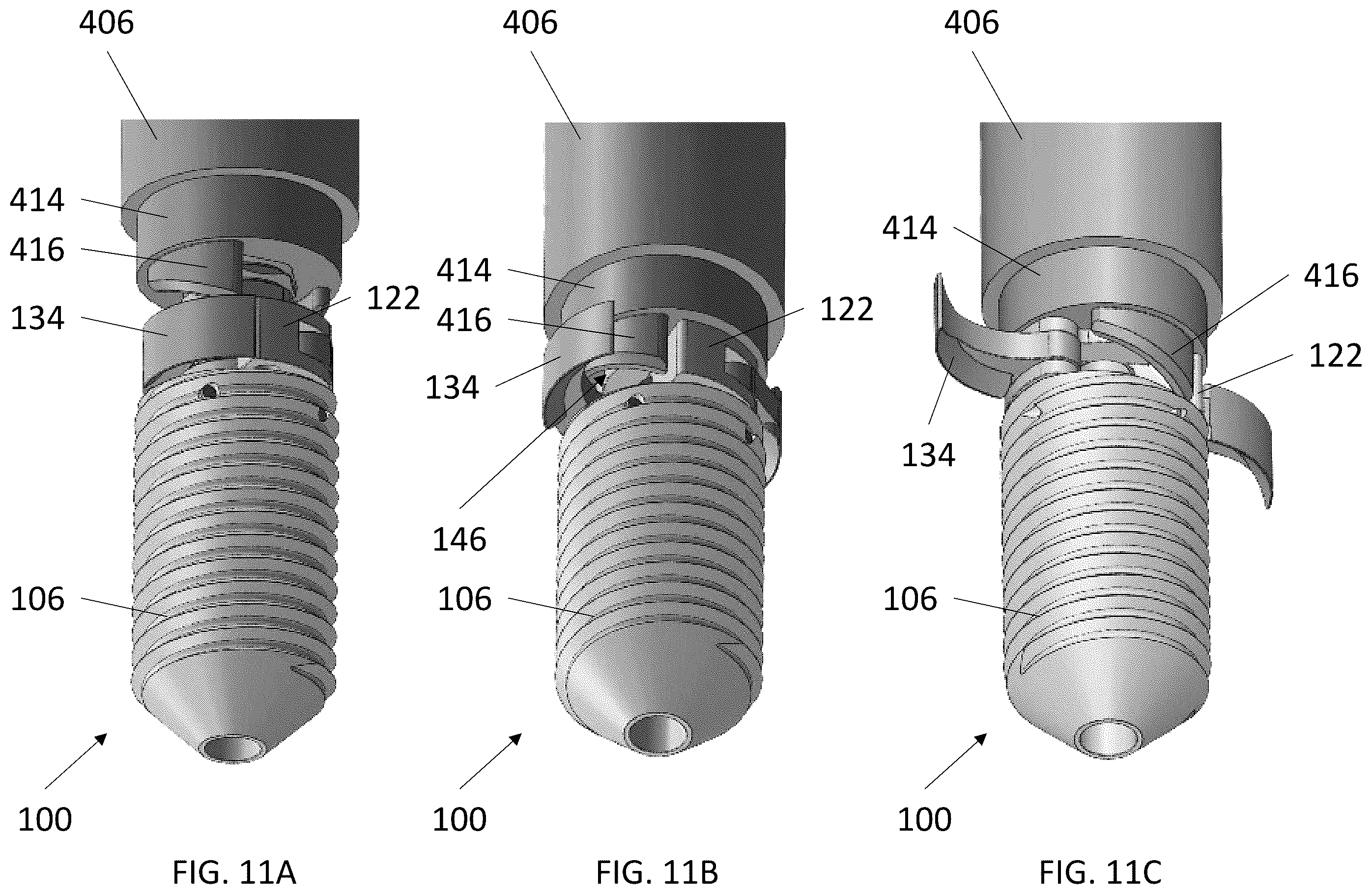 Patent US12569240 Figure 12 – Decorticating screw