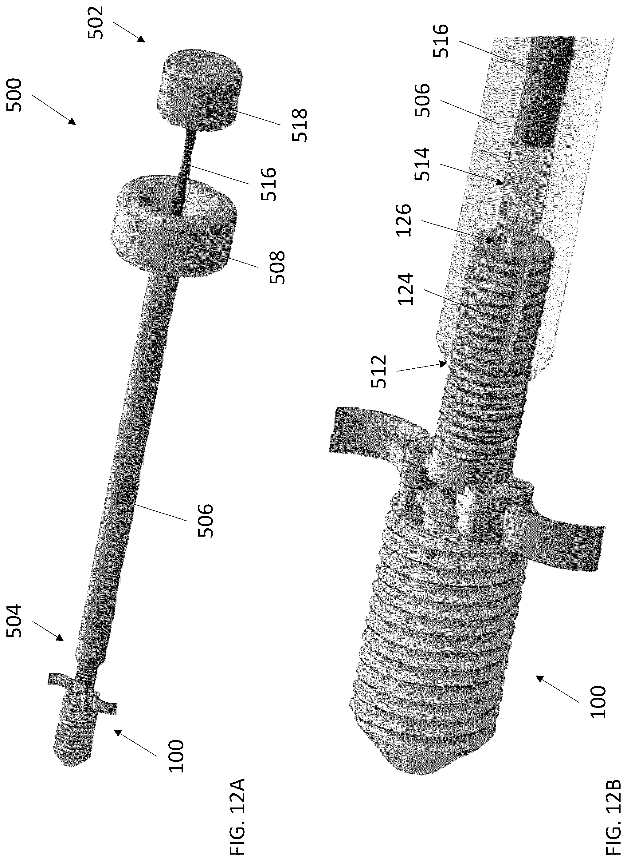Patent US12569240 Figure 13 – Decorticating screw